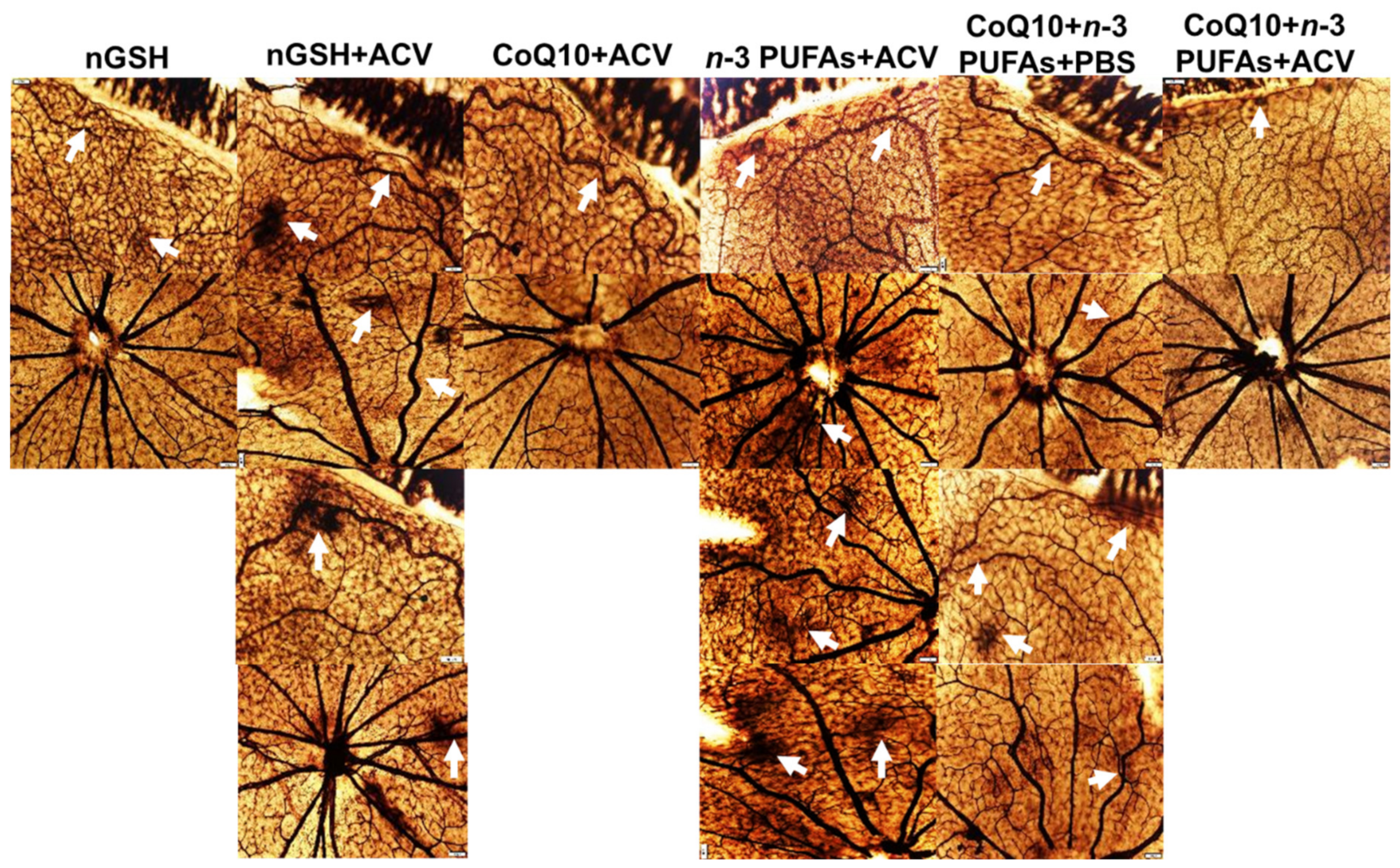 Nutrients 12 01980 g008