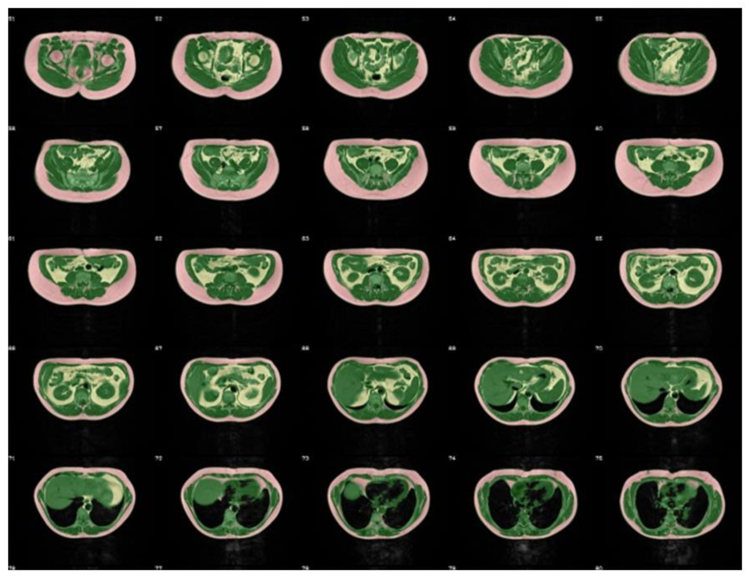 Nutrients 12 02064 g001 Nutrients 12 02064 g001