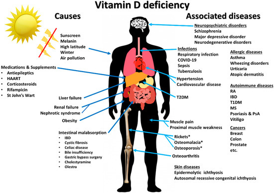 antibiotikumok kezelési diagramjai a prosztatitis