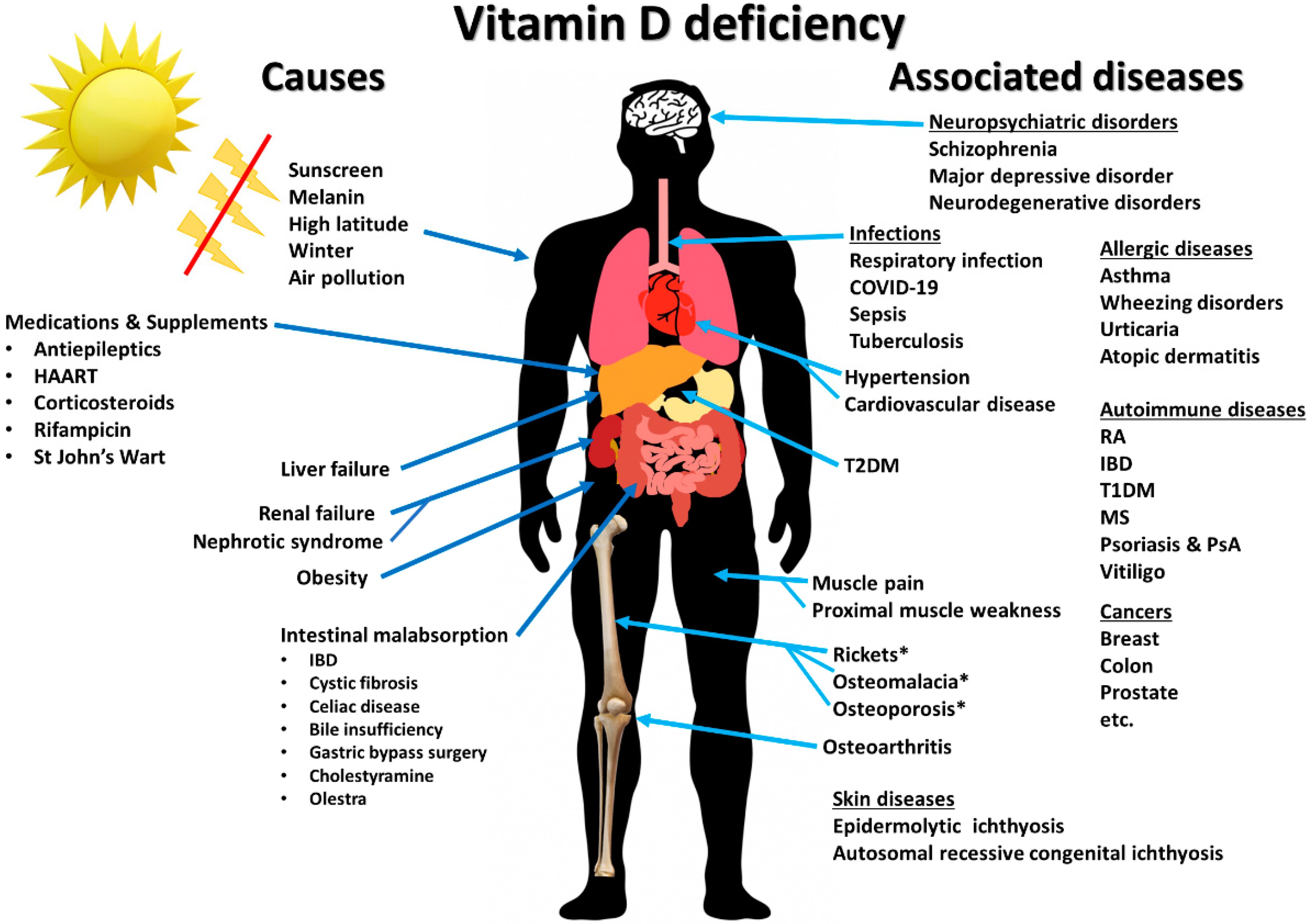 Vitamin D Deficiency Rash