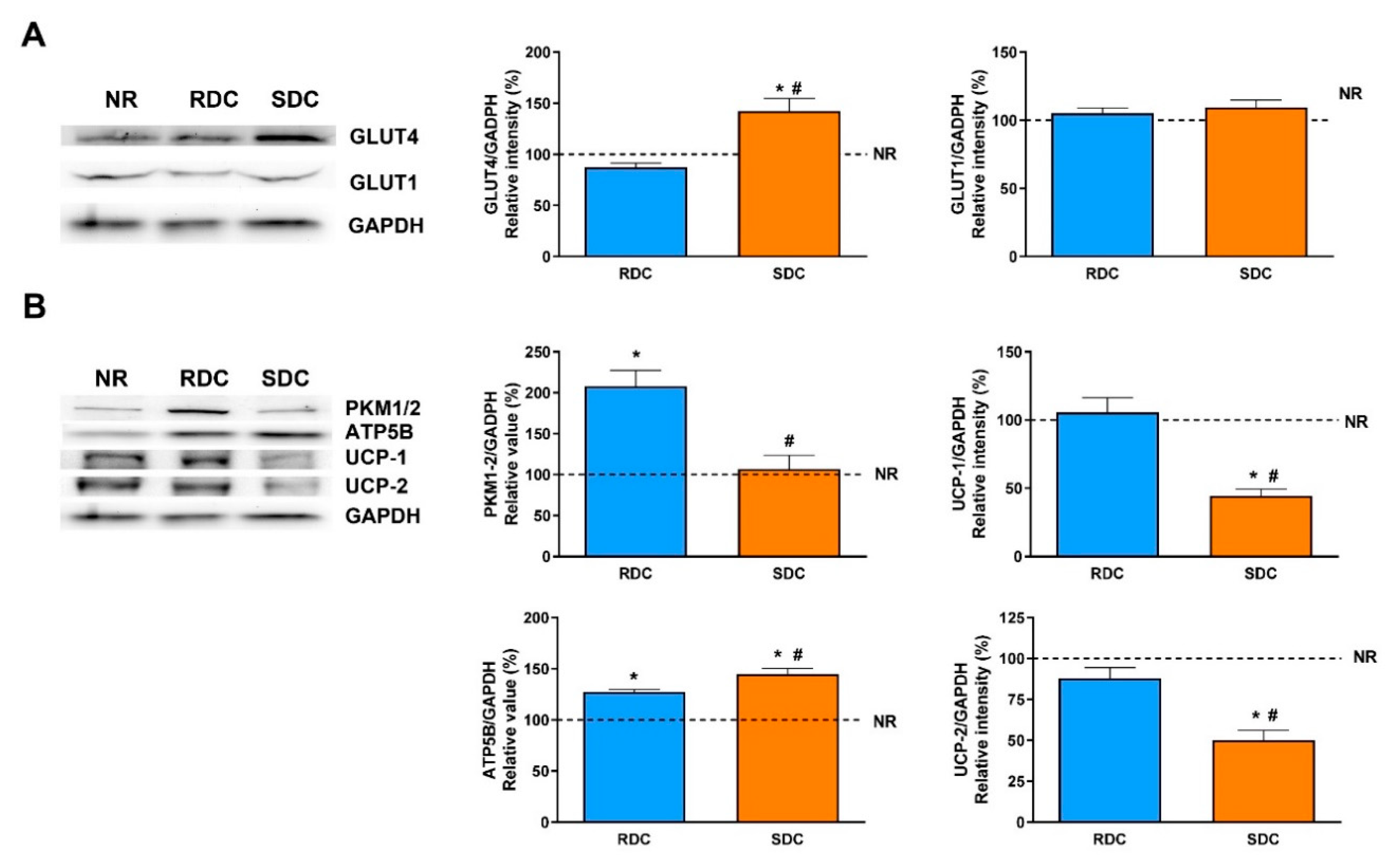 Nutrients Free Full Text Dietary Complex And Slow Digestive Carbohydrates Prevent Fat Deposits During Catch Up Growth In Rats Html