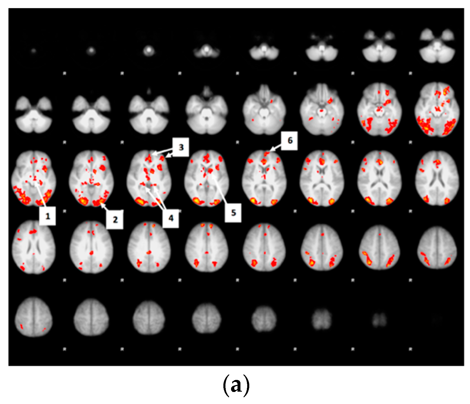 Nutrients 12 03283 g007a