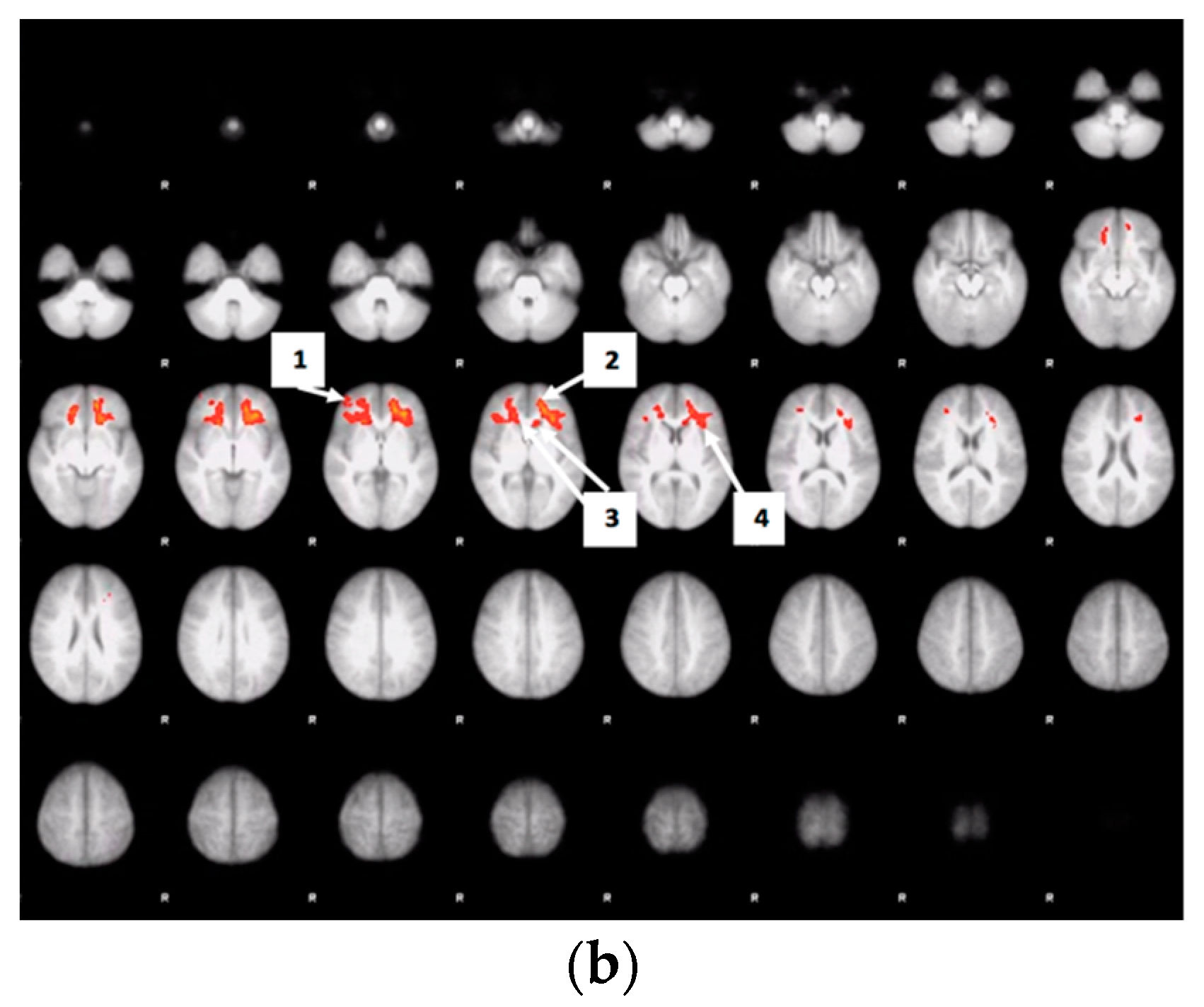 Nutrients 12 03283 g007b