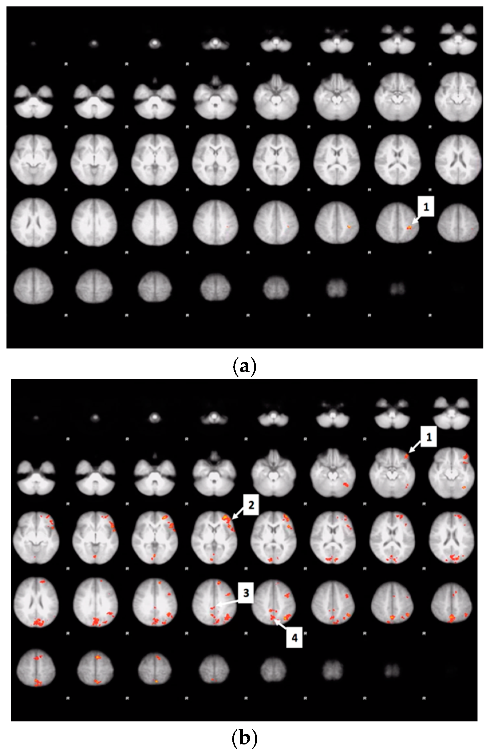 Nutrients 12 03283 g0a2