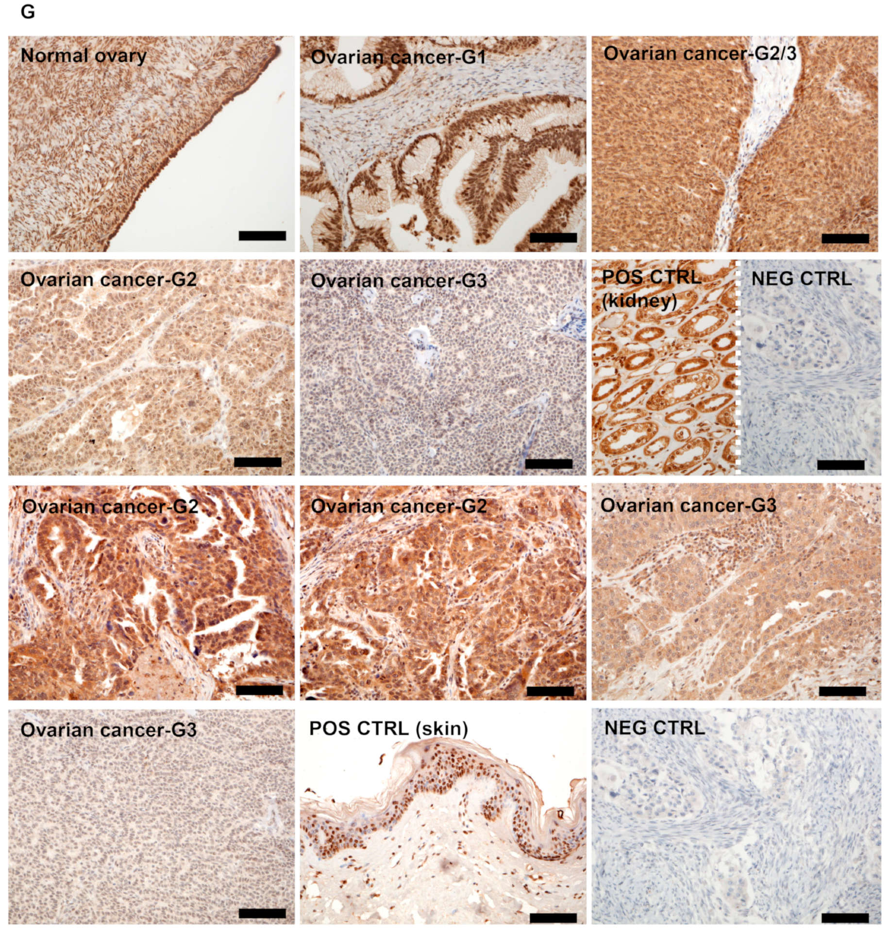 Nutrients 12 03541 g001b