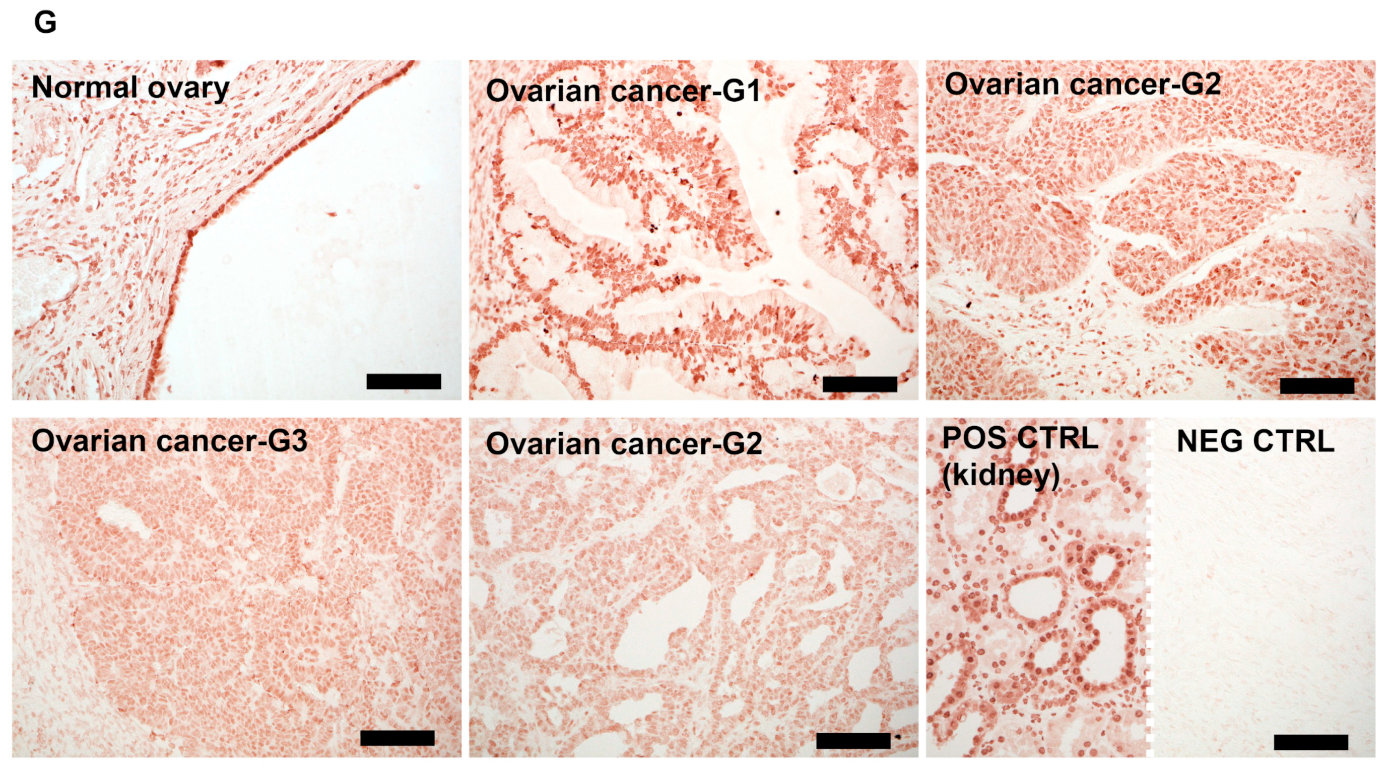 Nutrients 12 03541 g004b
