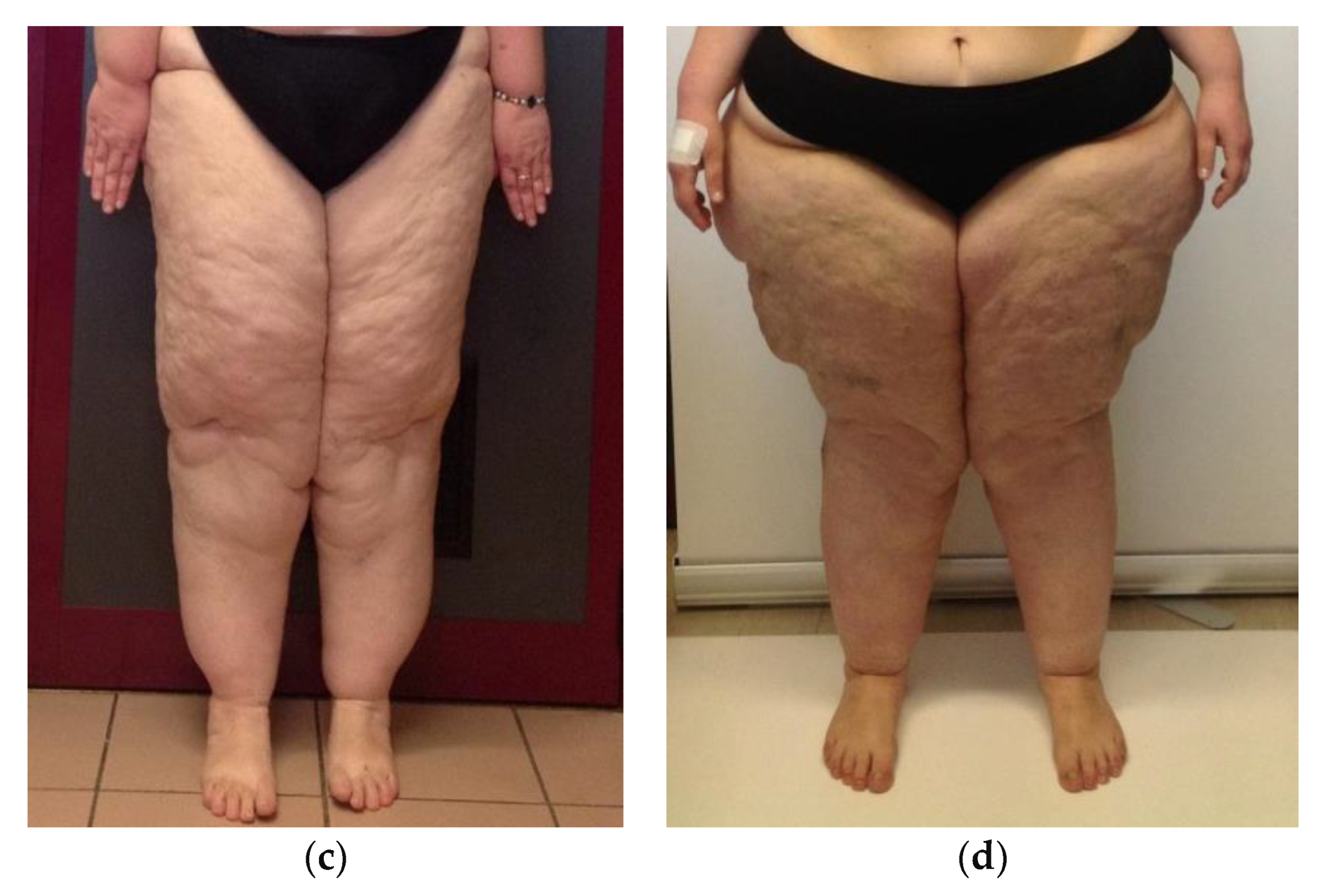 Nutrients 13 00358 g001b