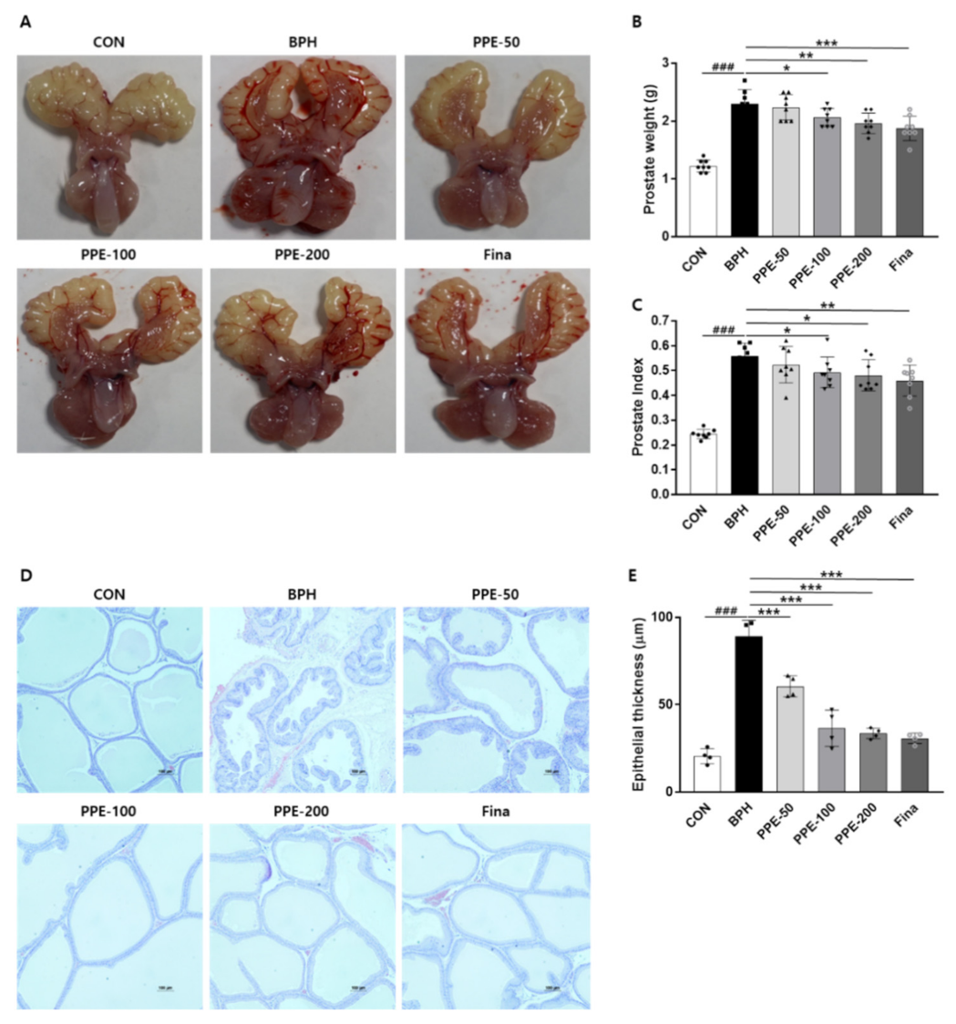 testosterone and enlarged prostate