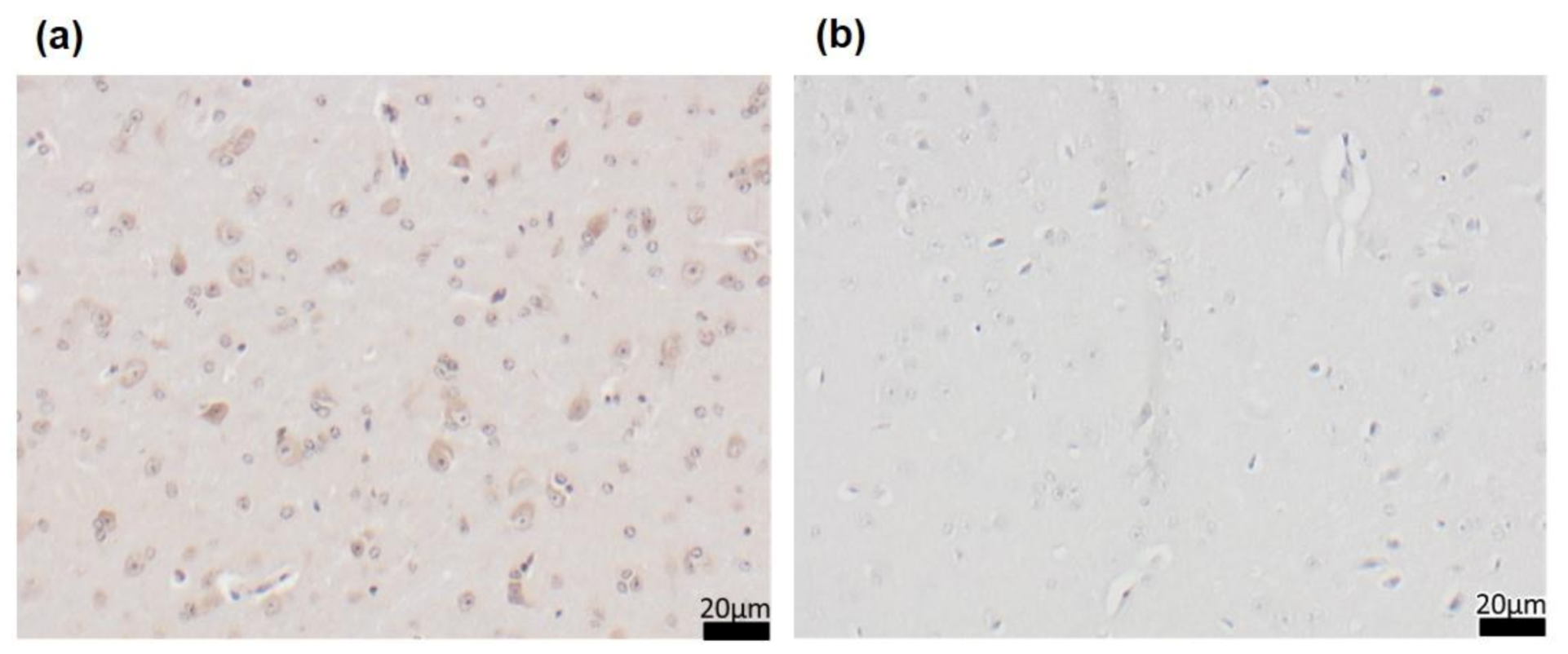 Nutrients 13 00985 g0a1 Nutrients 13 00985 g0a1