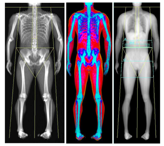 Nutrients 13 01075 i001 Nutrients 13 01075 i001