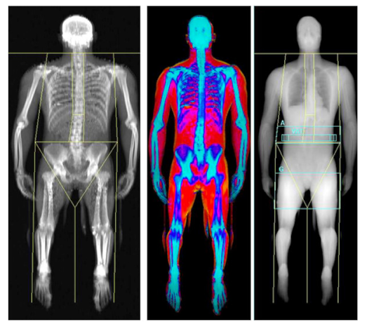 Nutrients 13 01075 i003 Nutrients 13 01075 i003