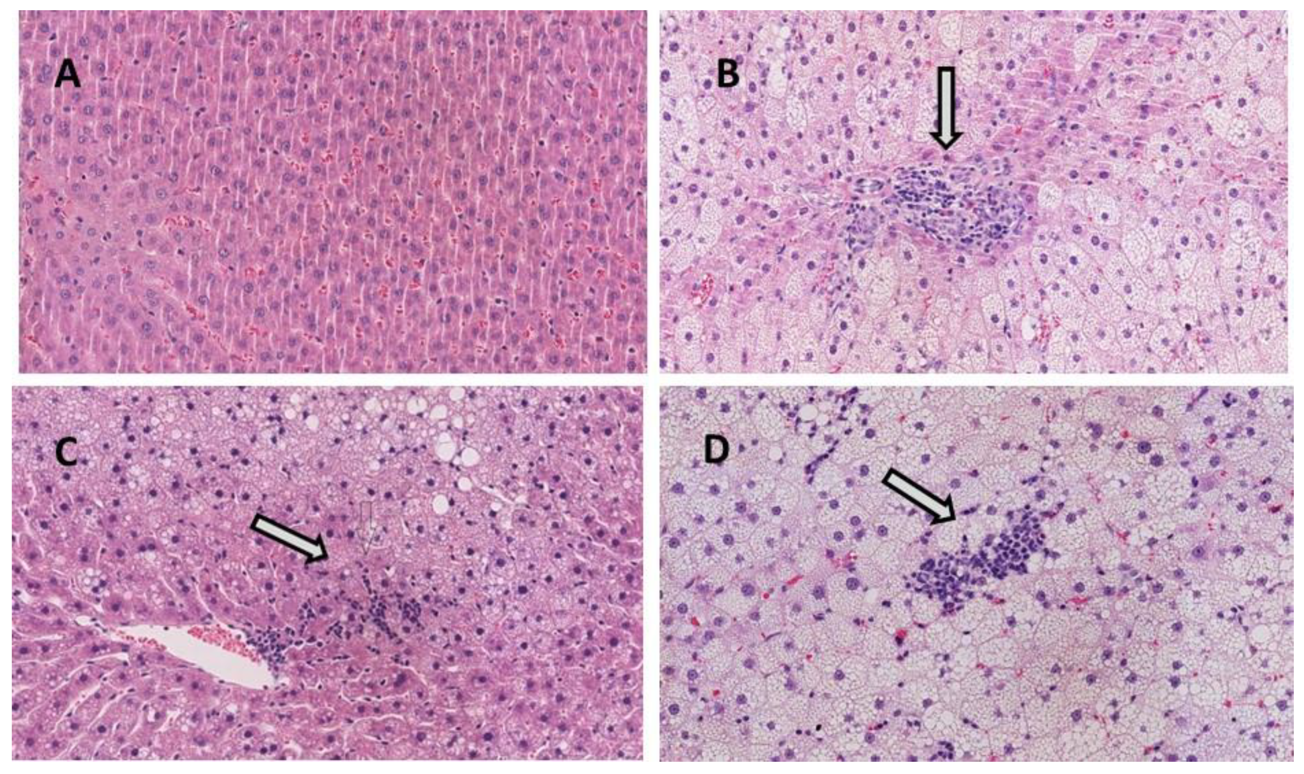 Nutrients 13 01738 g002 Nutrients 13 01738 g002