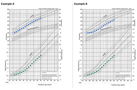Early Enteral Feeding in Preterm Infants: A Narrative Review of the ...