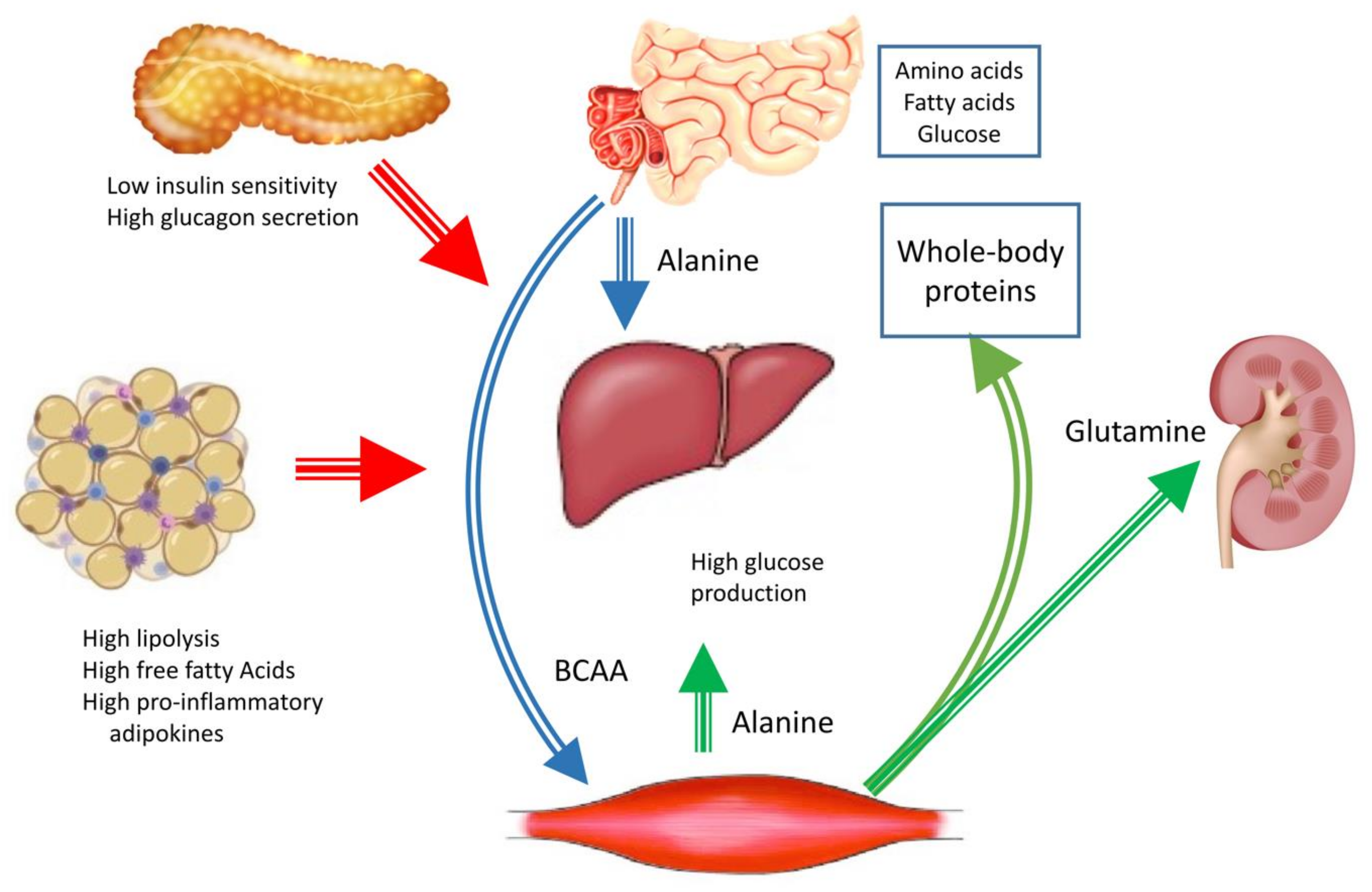 Cetosis diabetes y perdida peso articulo