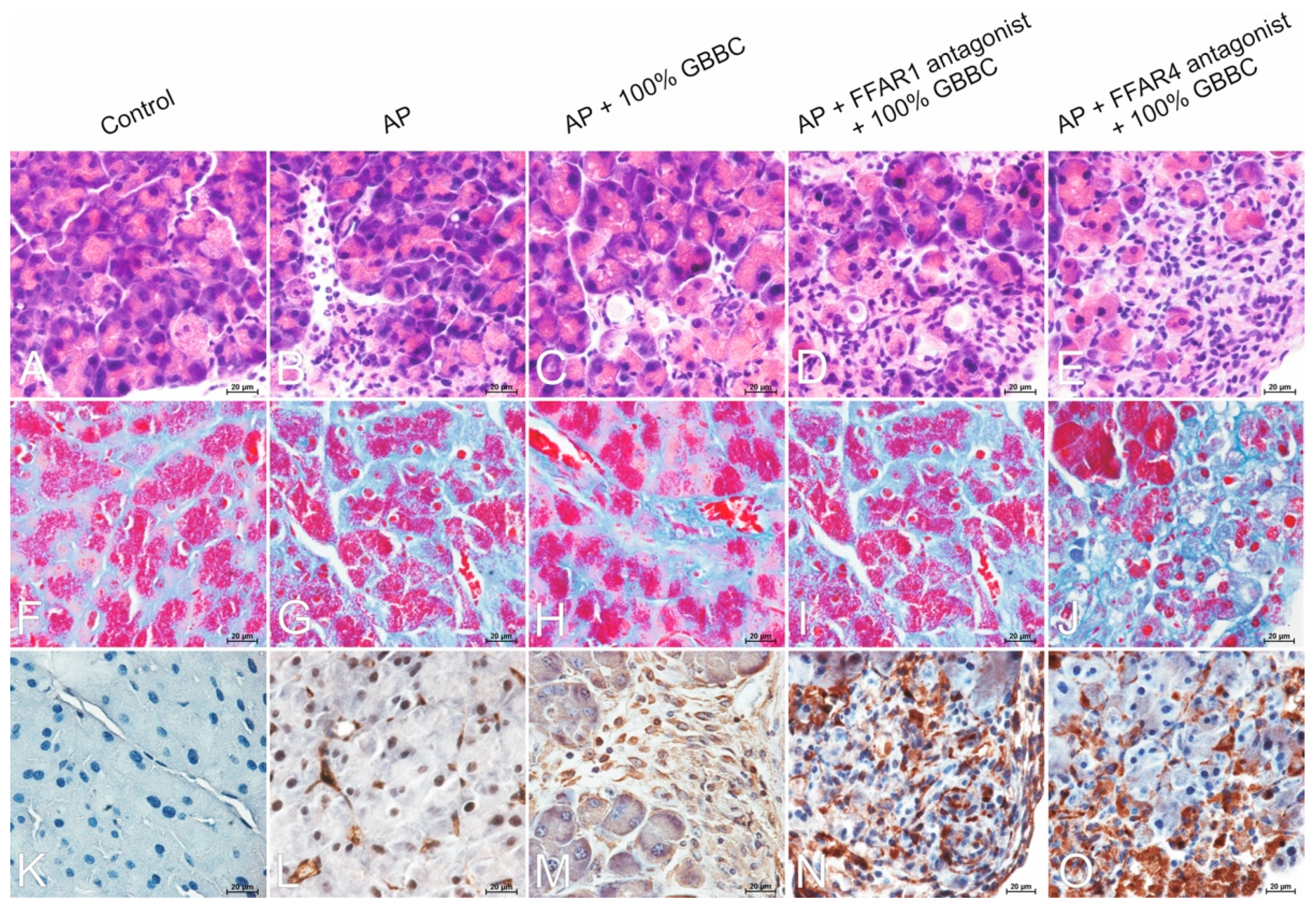 Nutrients 13 03271 g006 Nutrients 13 03271 g006