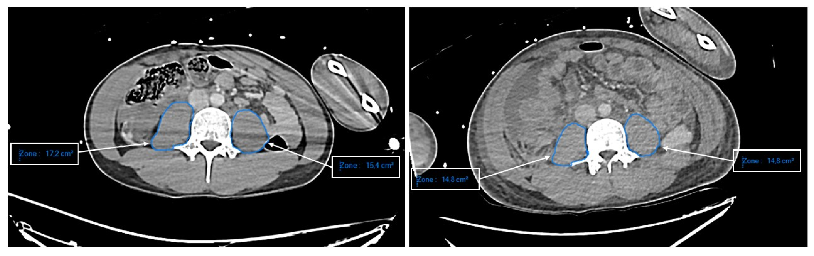 Nutrients 13 03554 g001 Nutrients 13 03554 g001
