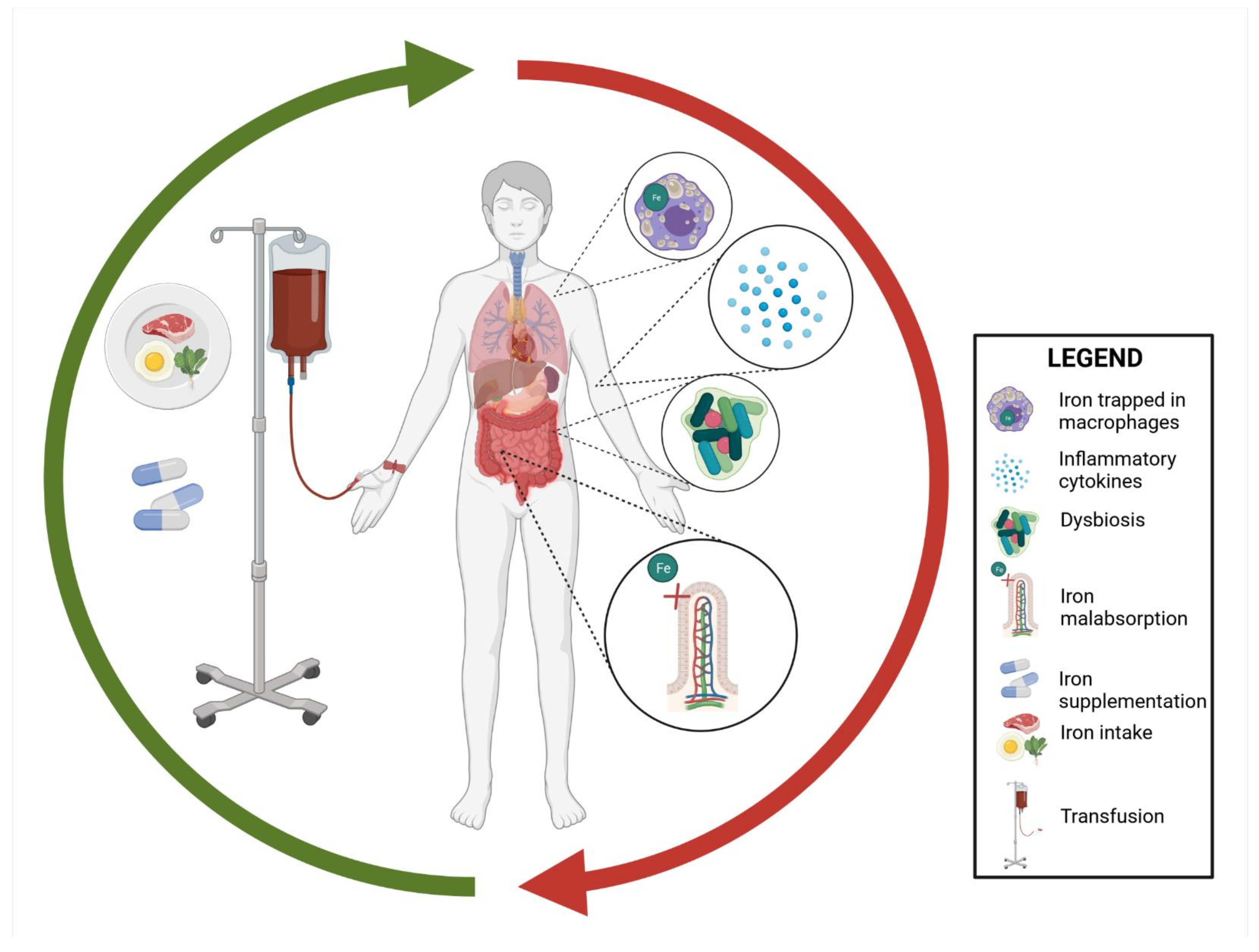 Nutrients | Free Full-Text | Iron Deficiency Anemia in Inflammatory Bowel Diseases—A Narrative Review Nutrients | Free Full-Text | Iron Deficiency Anemia in Inflammatory Bowel Diseases—A Narrative Review