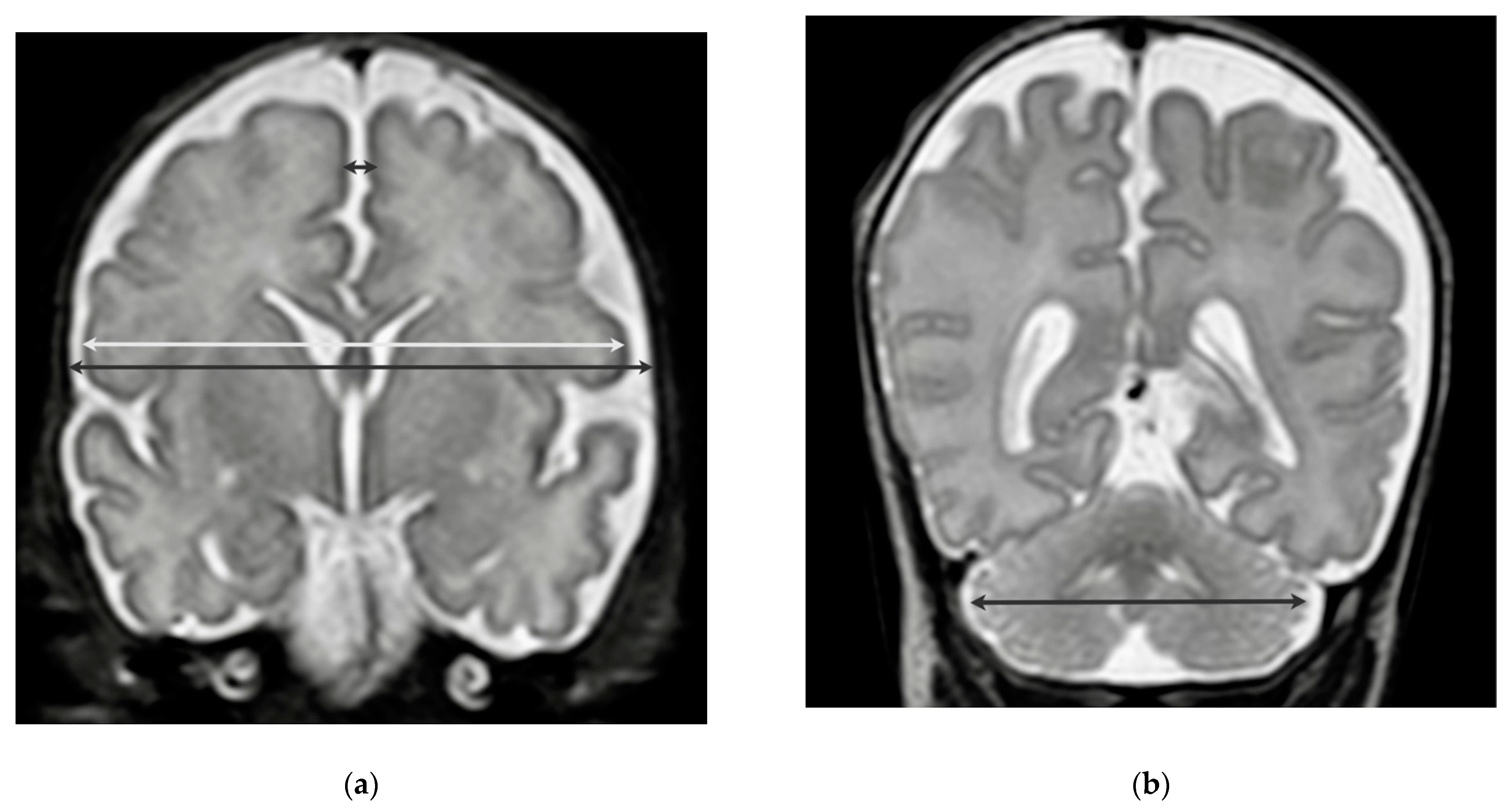 Nutrients 13 04205 g001 550
