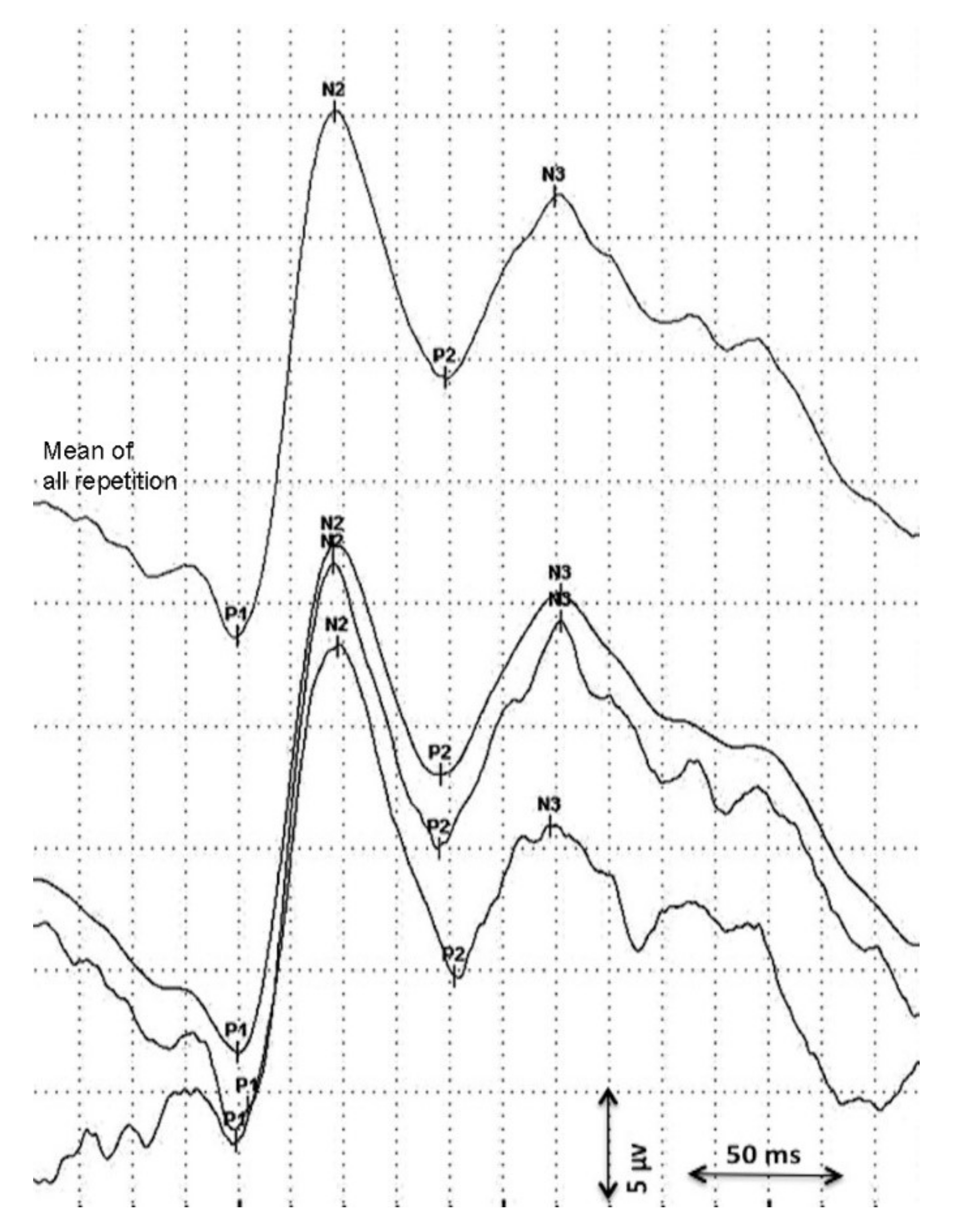 Nutrients 13 04241 g001 Nutrients 13 04241 g001