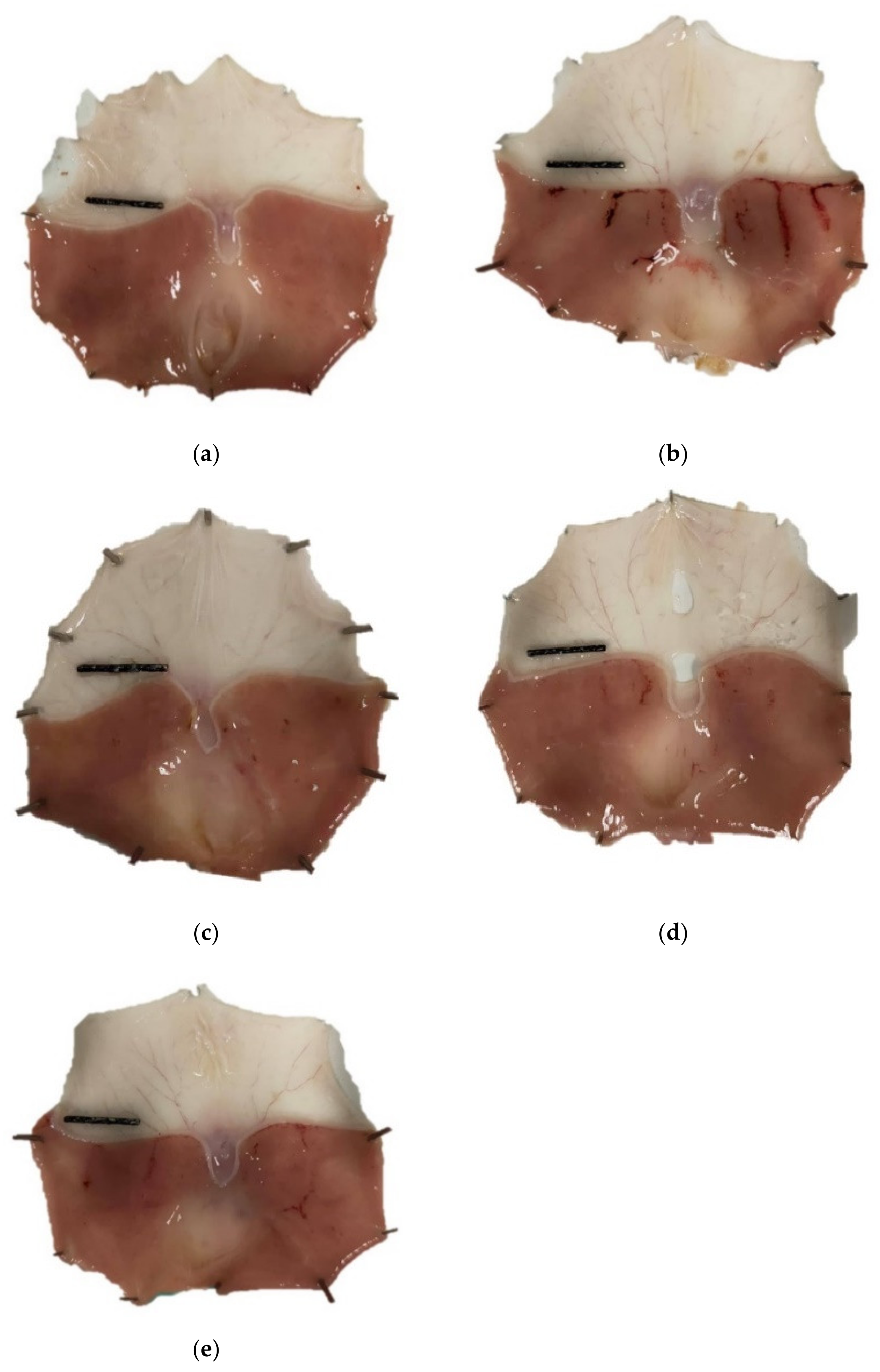 Nutrients 14 00172 g001 Nutrients 14 00172 g001