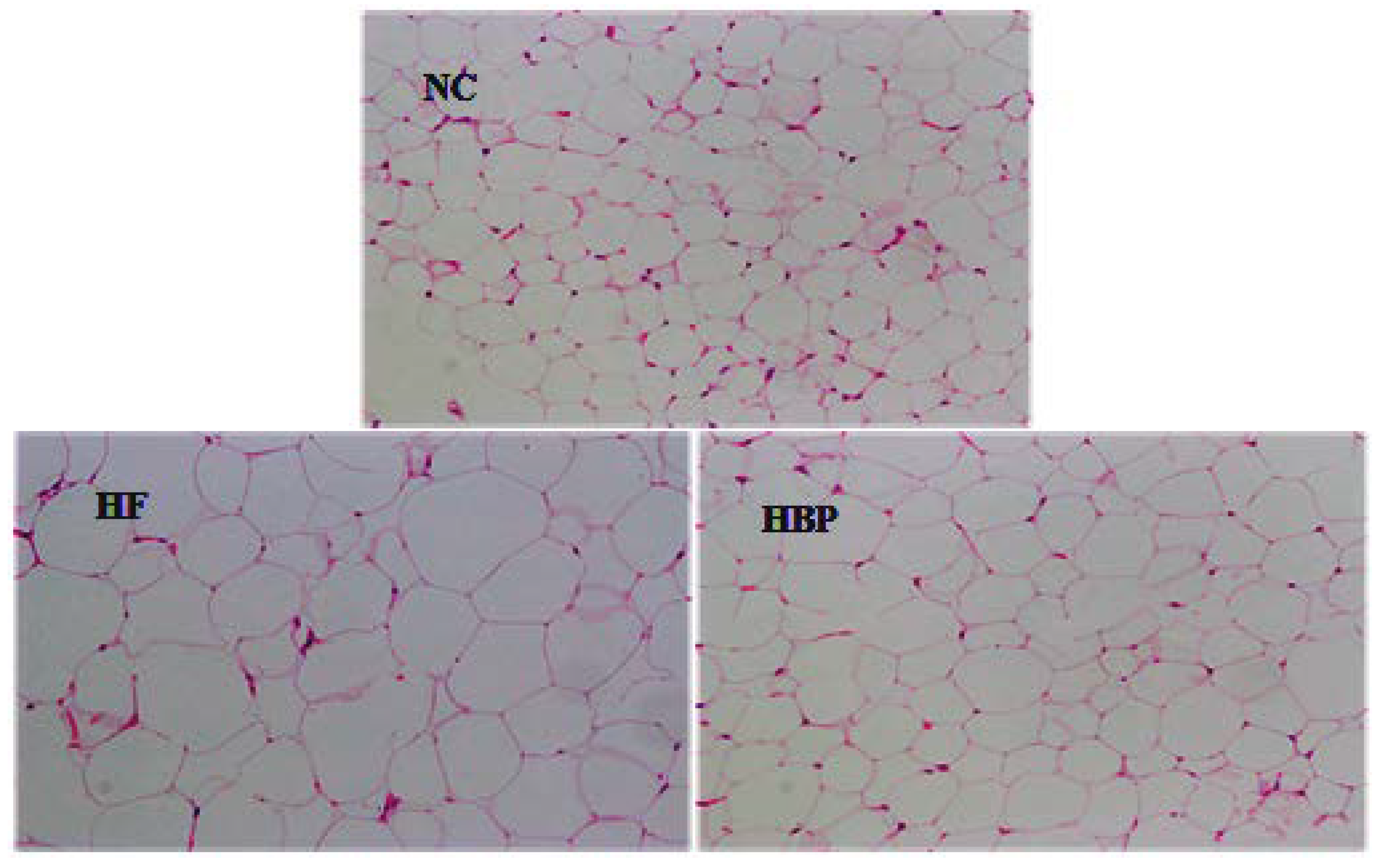 Nutrients 14 01277 g002 Nutrients 14 01277 g002
