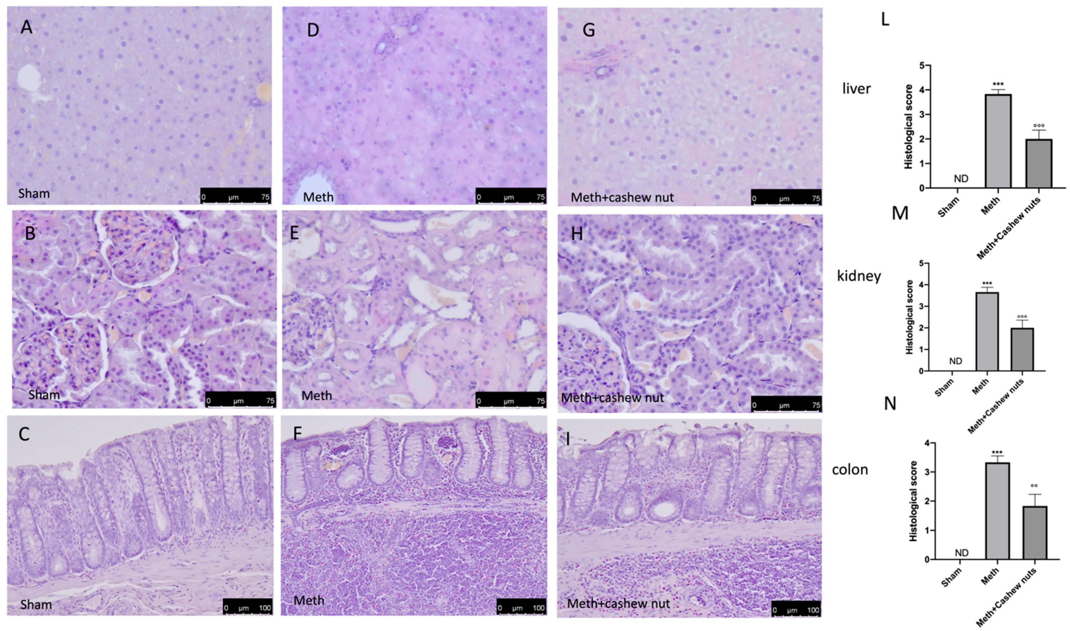Nutrients 14 01474 g003 Nutrients 14 01474 g003
