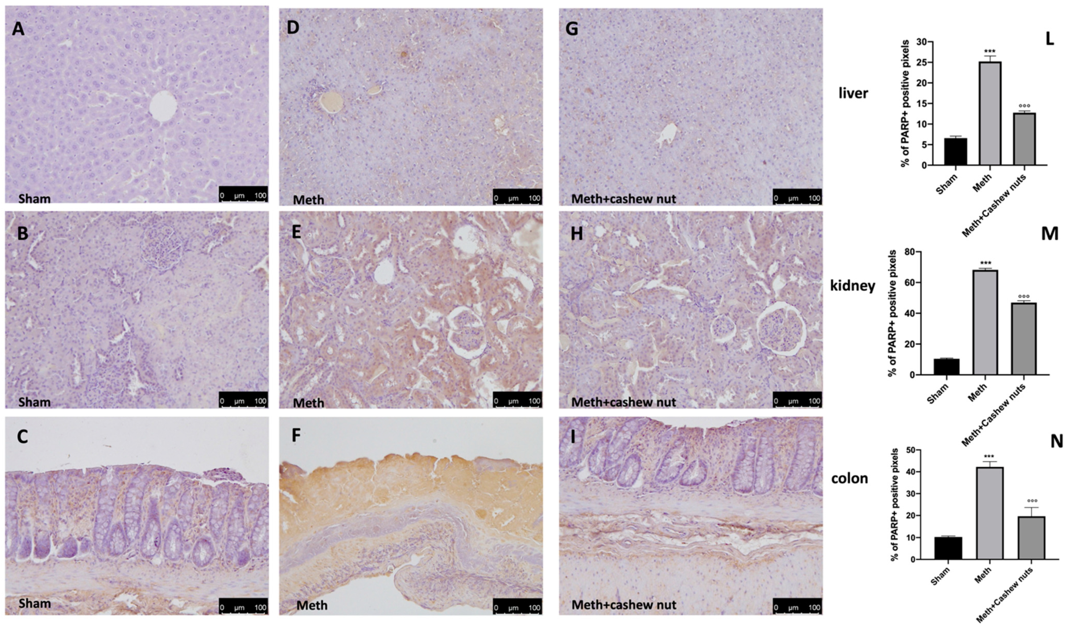Nutrients 14 01474 g006 Nutrients 14 01474 g006