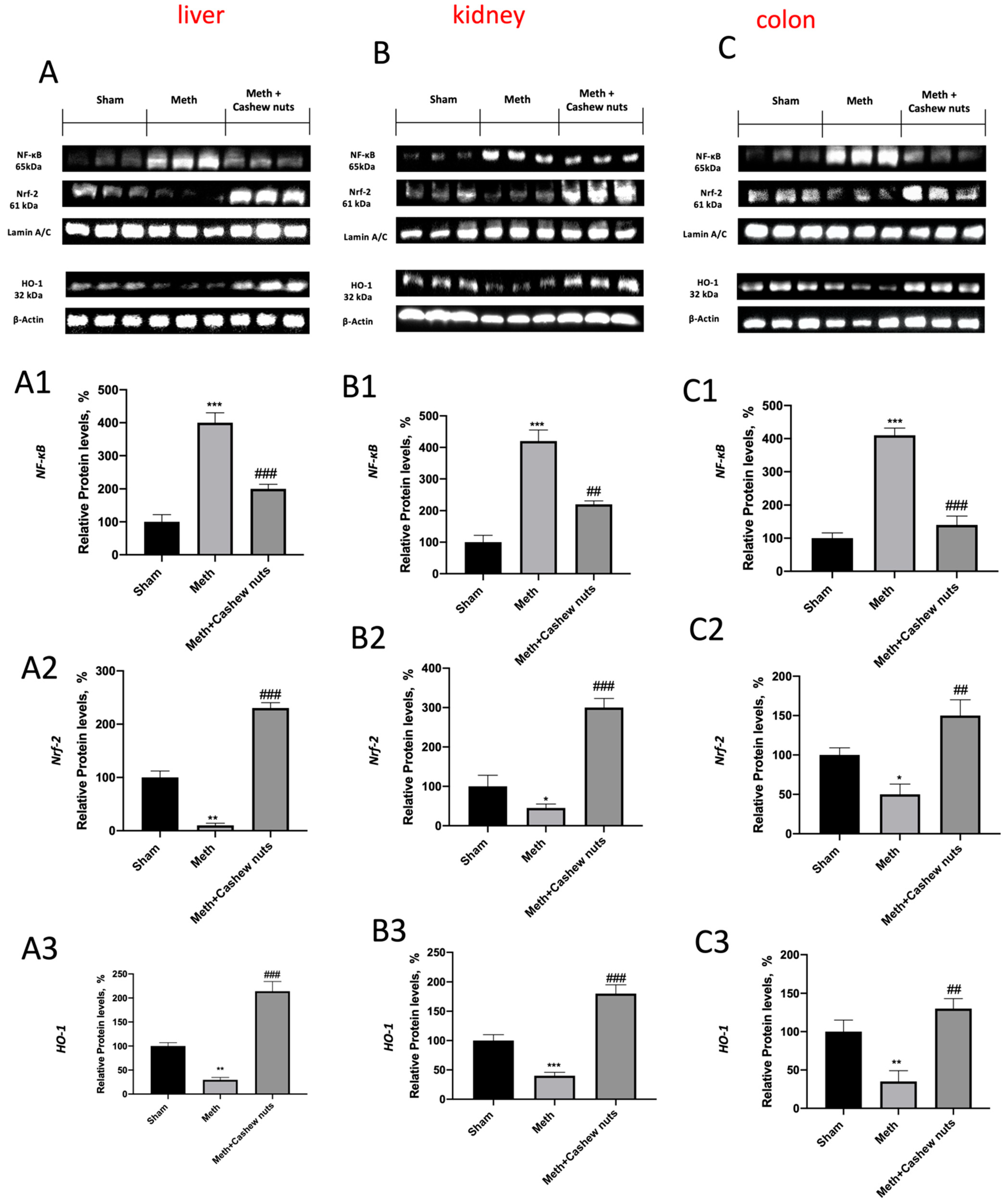 Nutrients 14 01474 g007 Nutrients 14 01474 g007