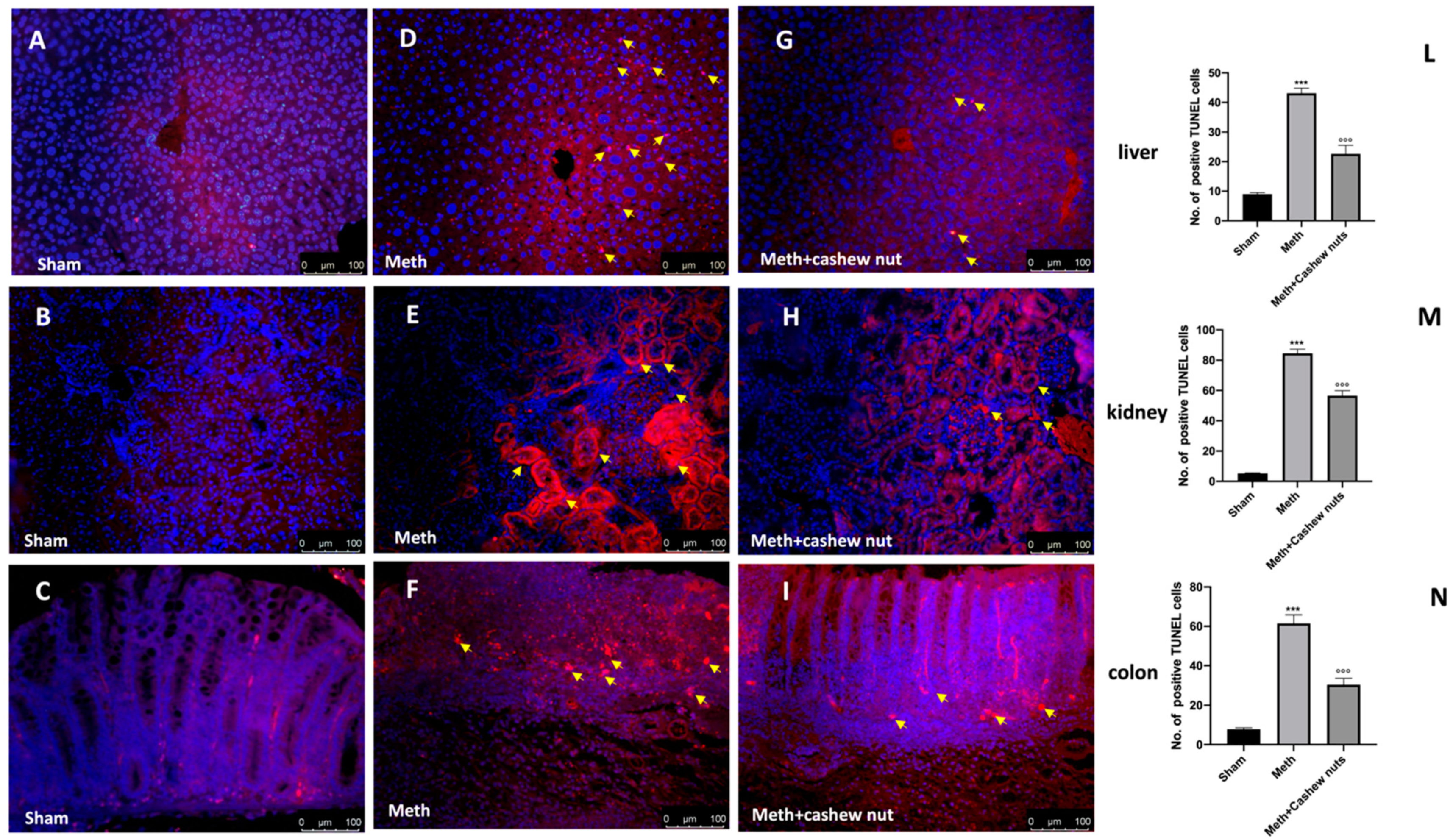 Nutrients 14 01474 g008 Nutrients 14 01474 g008