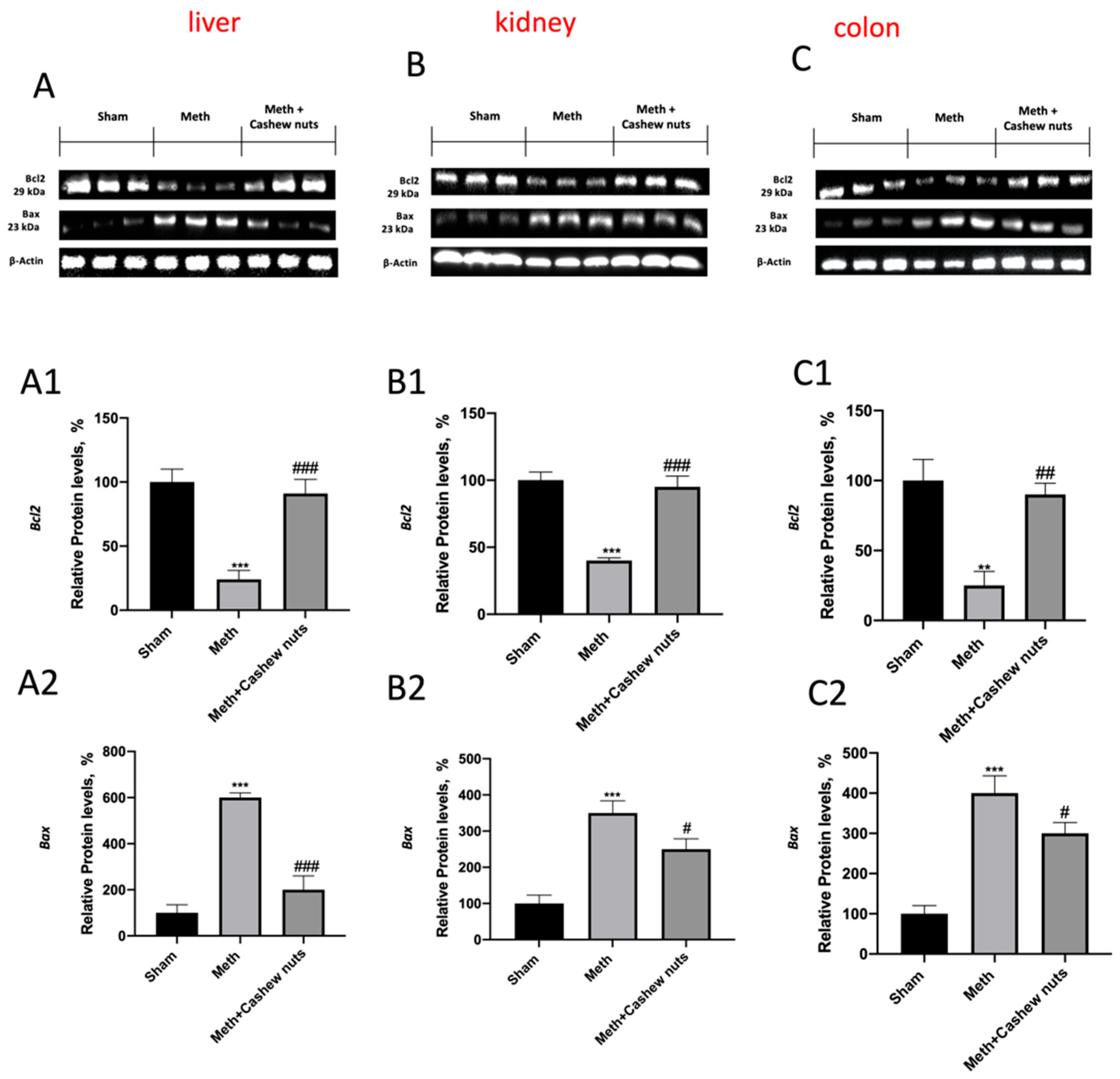 Nutrients 14 01474 g009 Nutrients 14 01474 g009