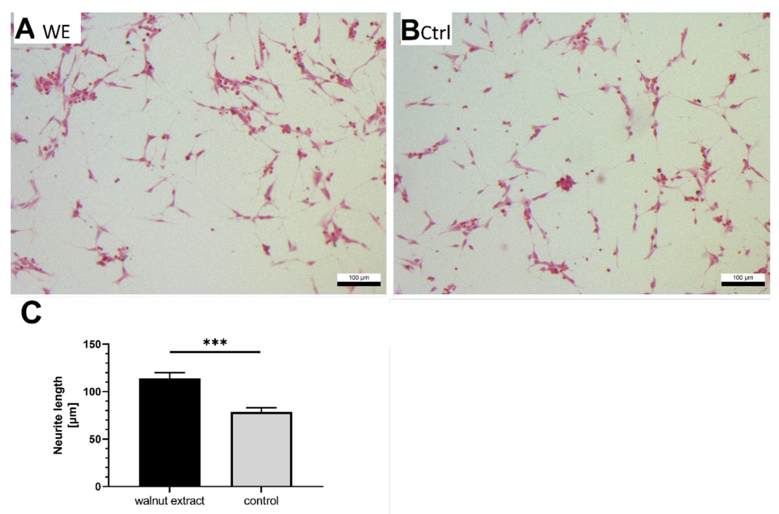 Nutrients 14 01694 g004