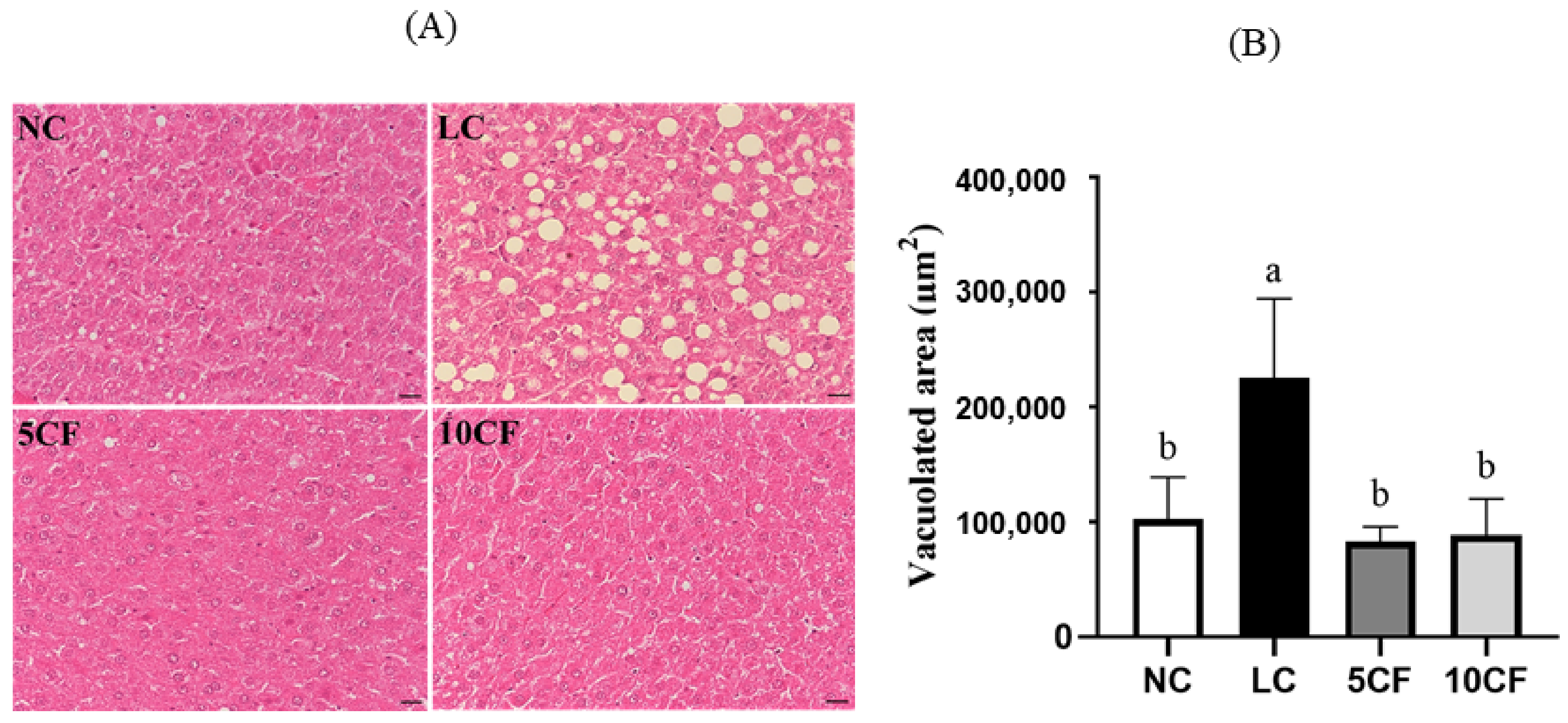 Nutrients 14 01796 g006 Nutrients 14 01796 g006