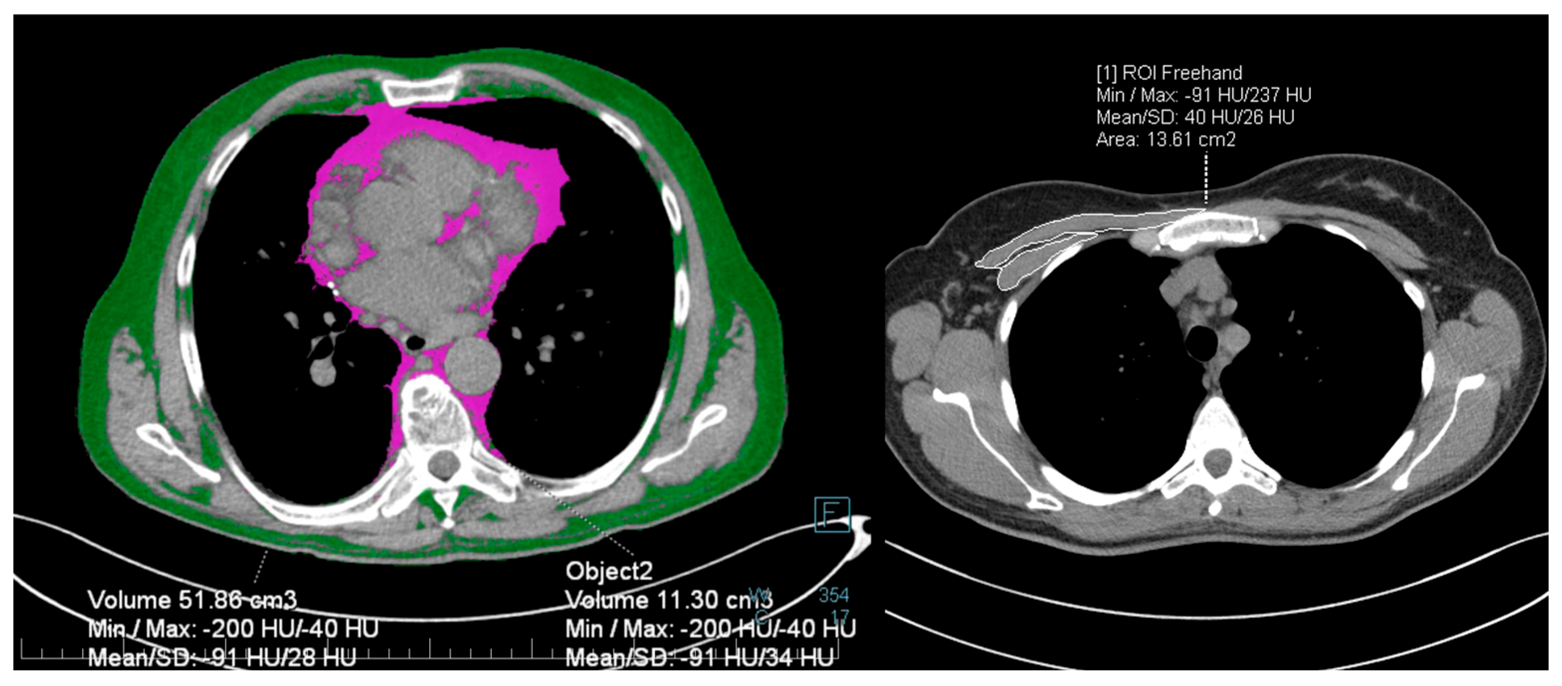 Nutrients 14 02105 g001