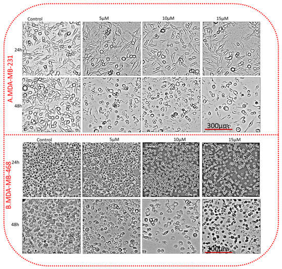 glutathione level mda mb 468 Thymoquinone Alterations of the Apoptotic Gene Expressions and Cell Cycle  Arrest in Genetically Distinct Triple-Negative Breast Cancer Cells