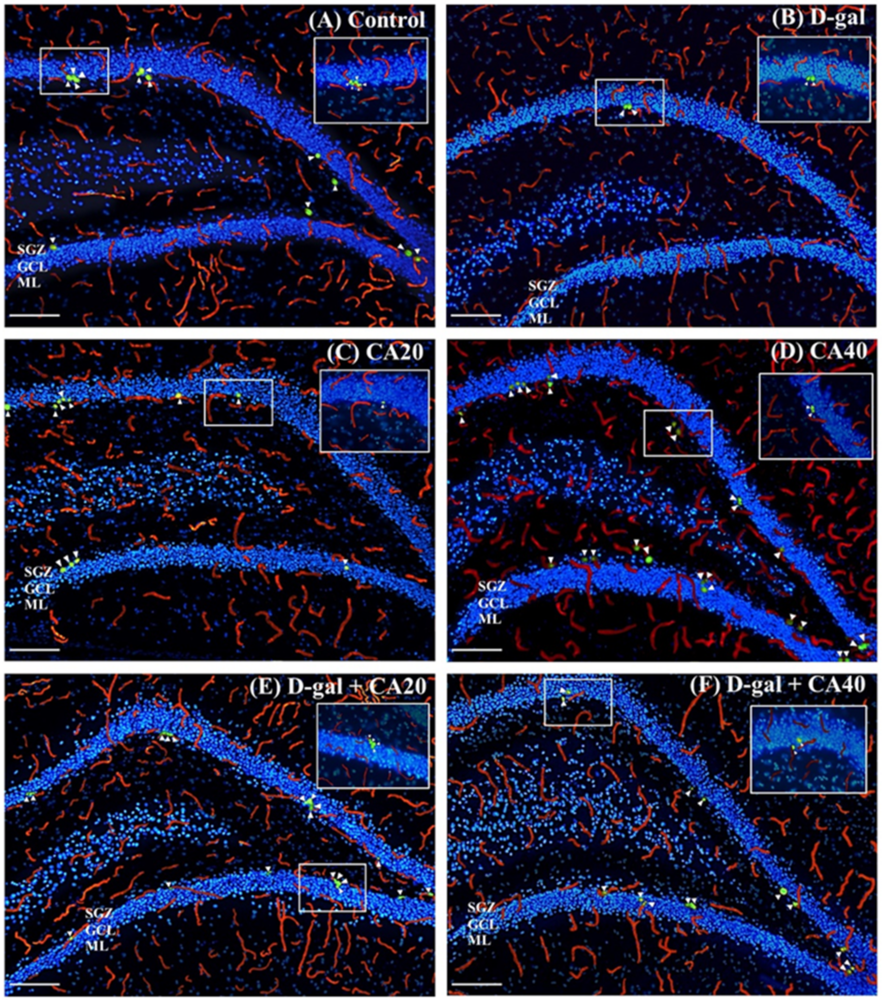 Nutrients 14 02169 g005a Nutrients 14 02169 g005a