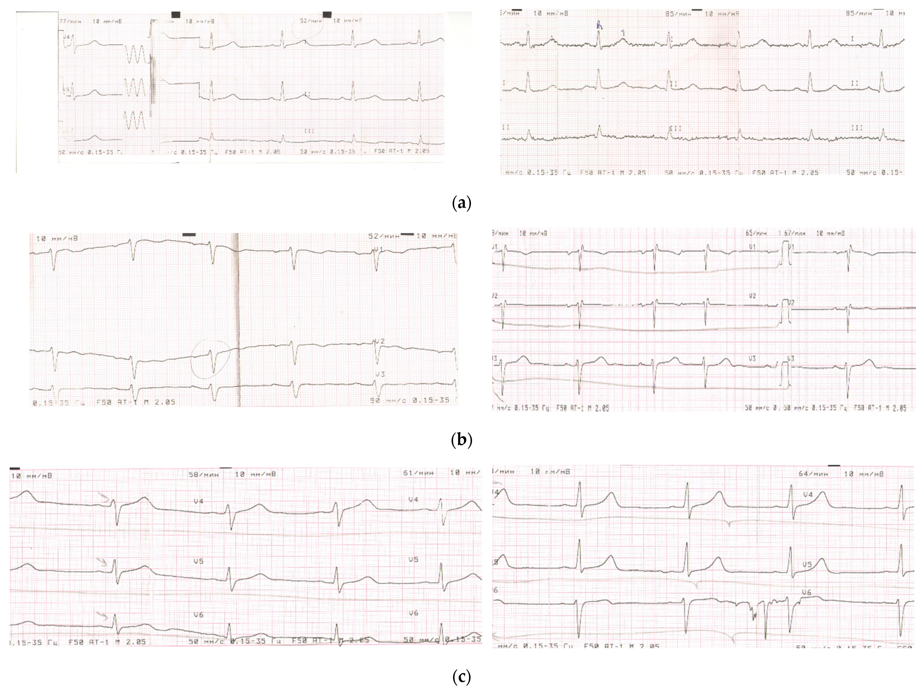 Nutrients 14 02203 g0a1 Nutrients 14 02203 g0a1