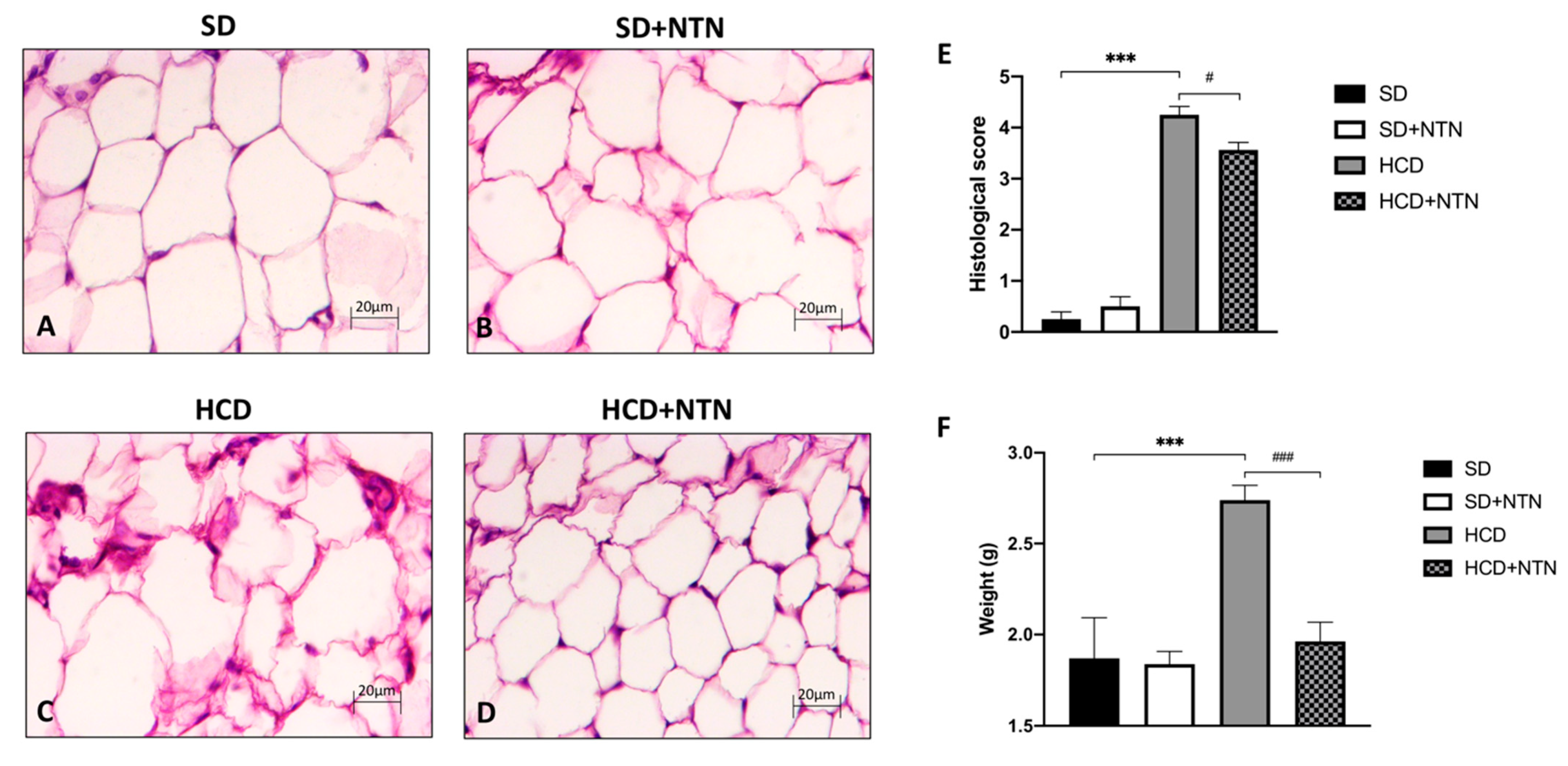 Nutrients 14 02251 g003 Nutrients 14 02251 g003