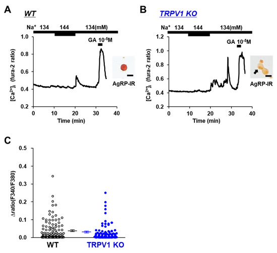 TRPV1-Mediated Sensing of Sodium and Osmotic Pressure in POMC Neurons in the Arcuate Nucleus of the Hypothalamus