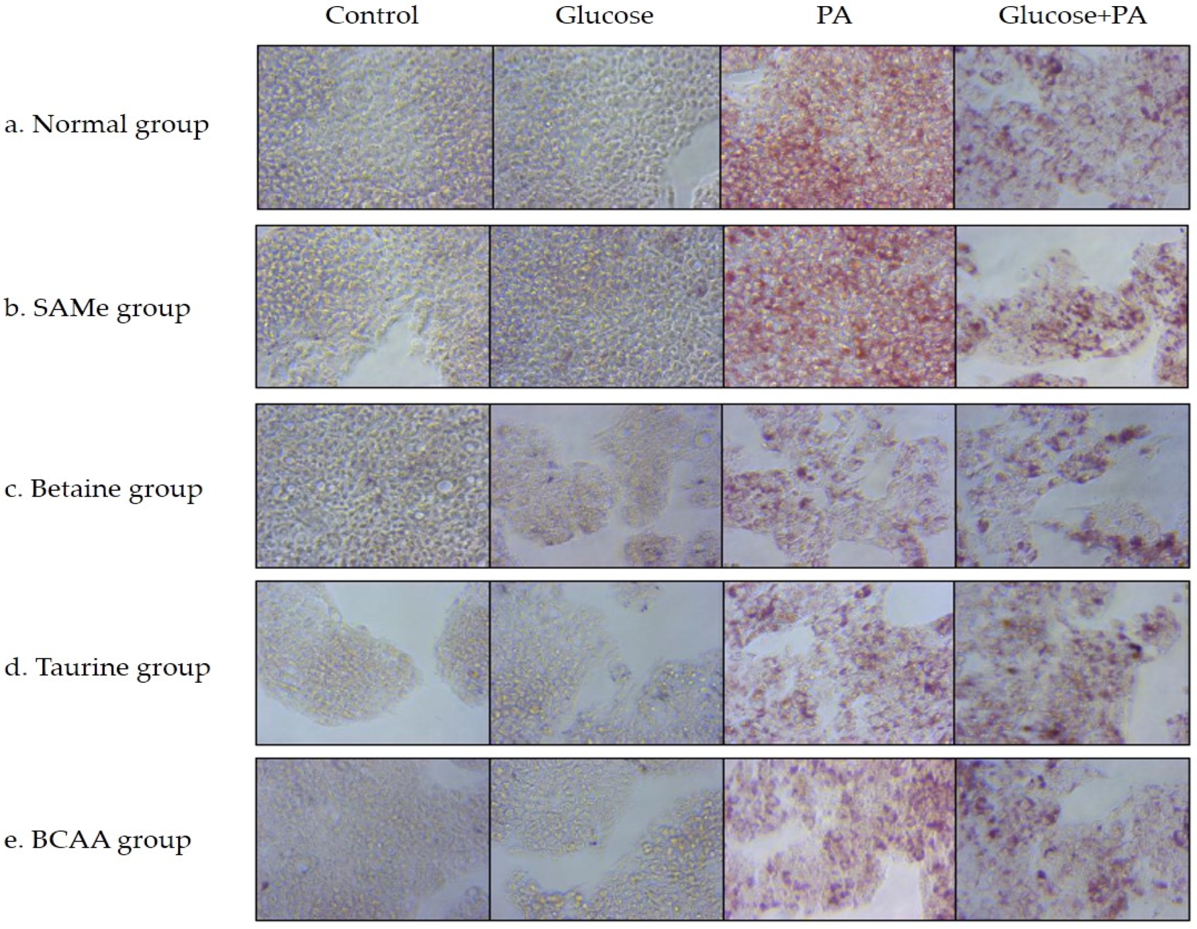 Nutrients 14 03050 g002 Nutrients 14 03050 g002