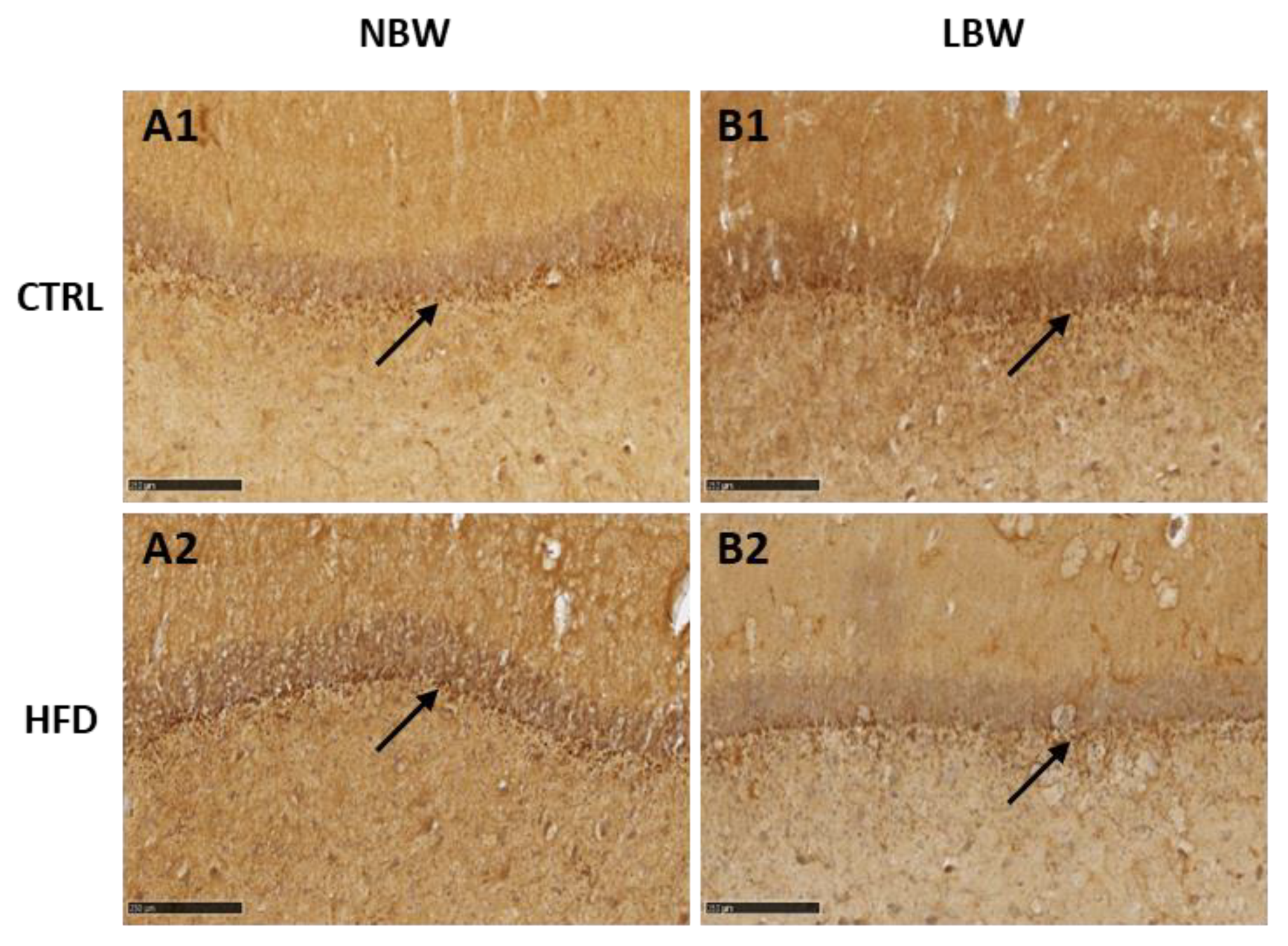 Nutrients 14 03440 g002 Nutrients 14 03440 g002