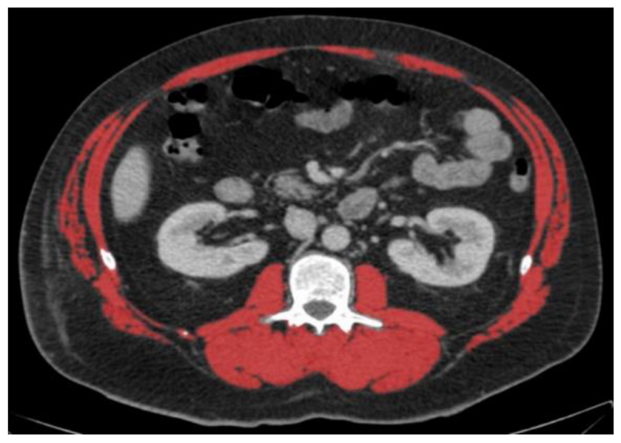 Nutrients 14 03446 i001 Nutrients 14 03446 i001