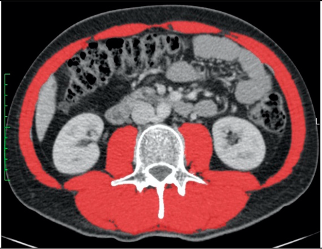 Nutrients 14 03446 i002 Nutrients 14 03446 i002