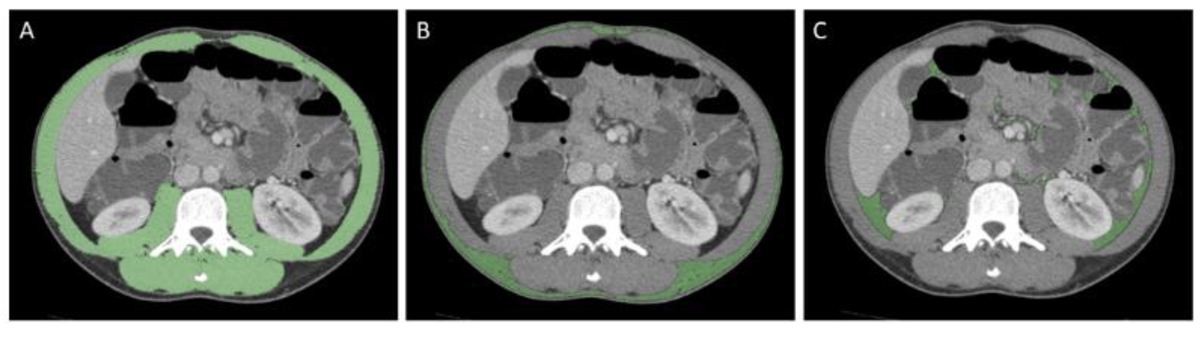 Nutrients 14 03460 g001