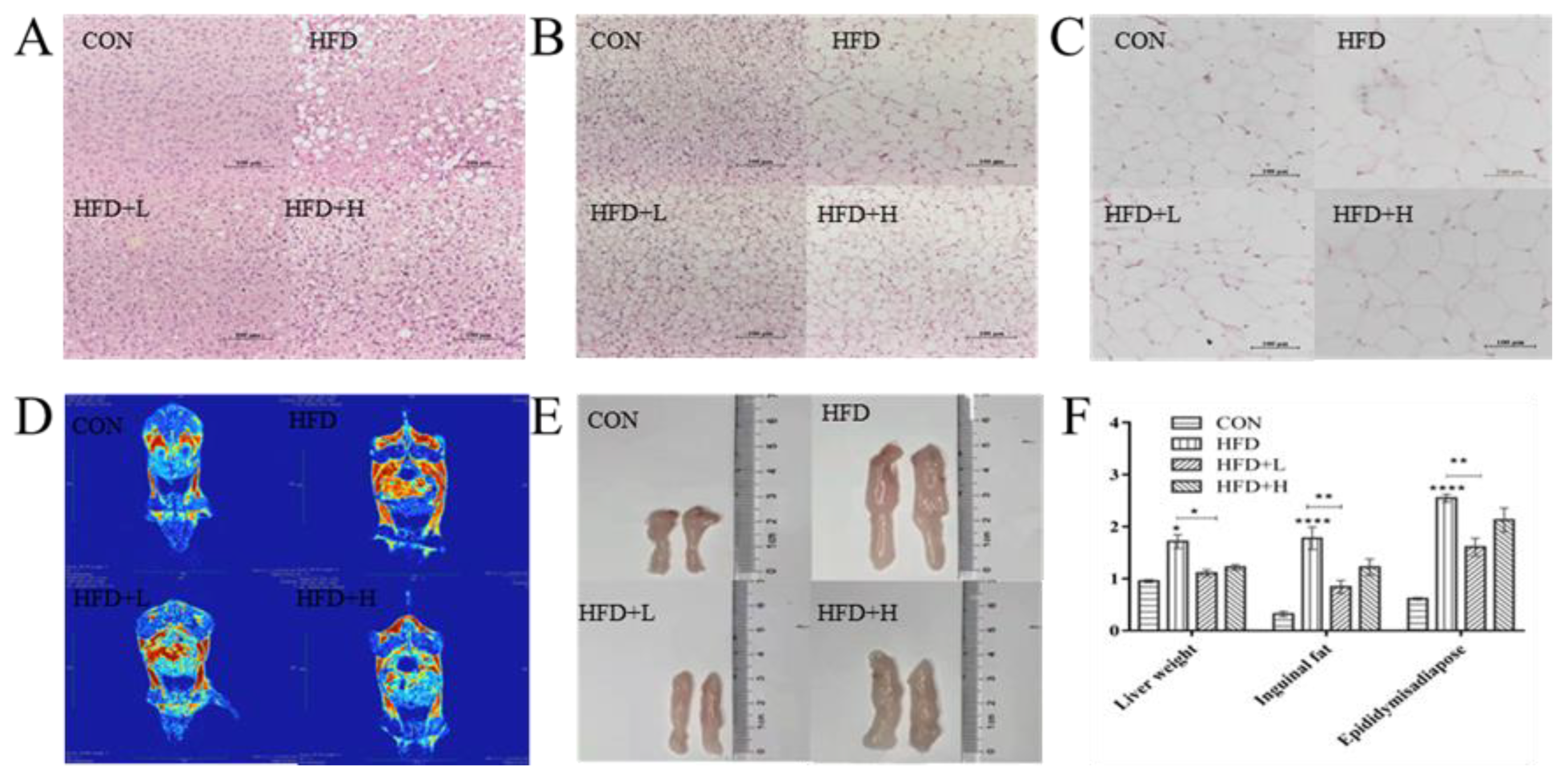 Nutrients 14 03928 g003 Nutrients 14 03928 g003