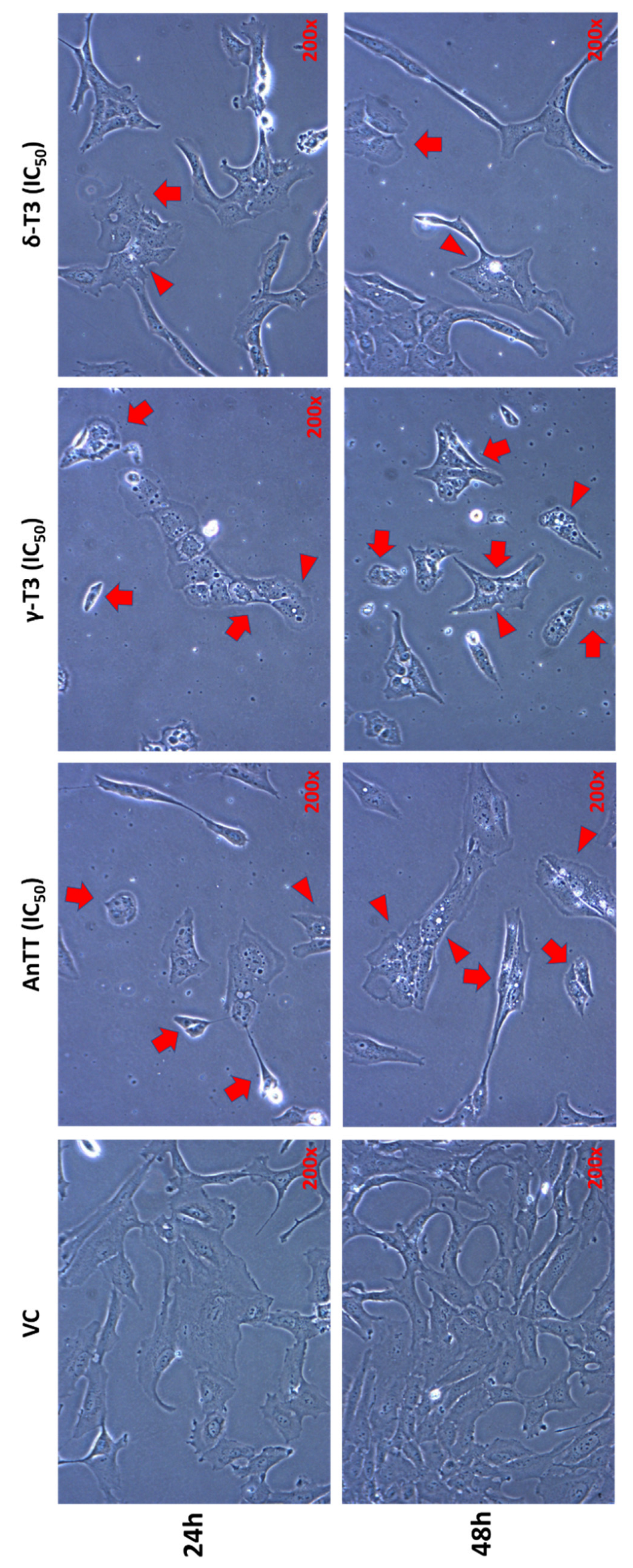 Nutrients 14 04277 g003 Nutrients 14 04277 g003
