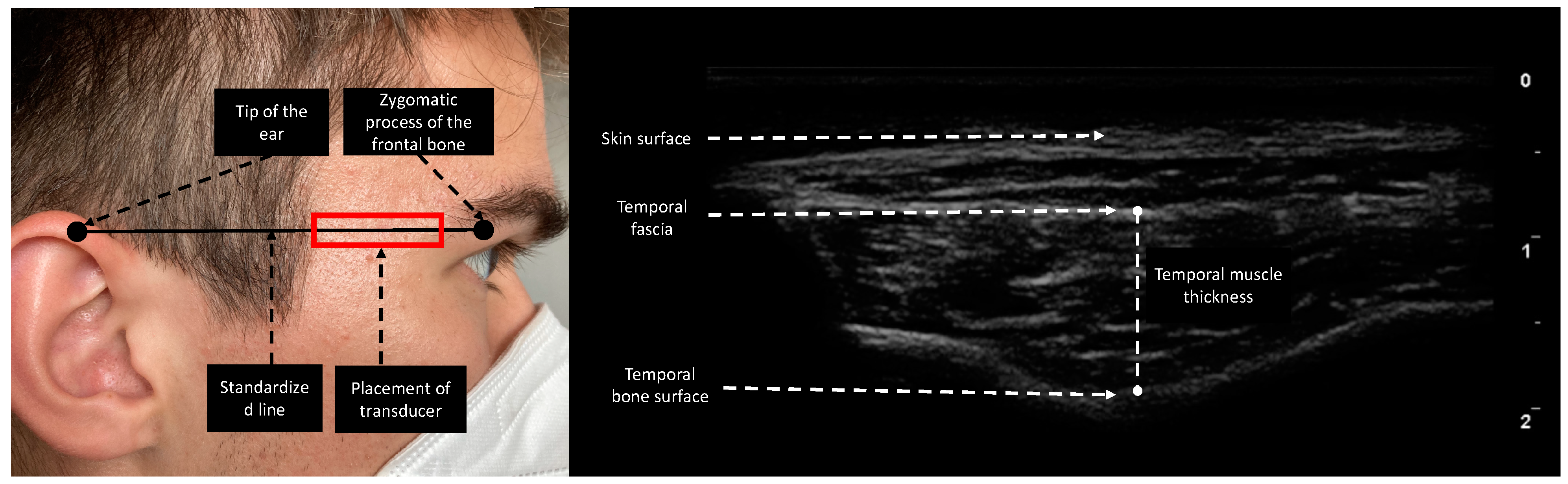 Nutrients 14 04498 g001 Nutrients 14 04498 g001