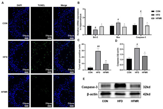 Methionine Restriction Improves Cognitive Ability by