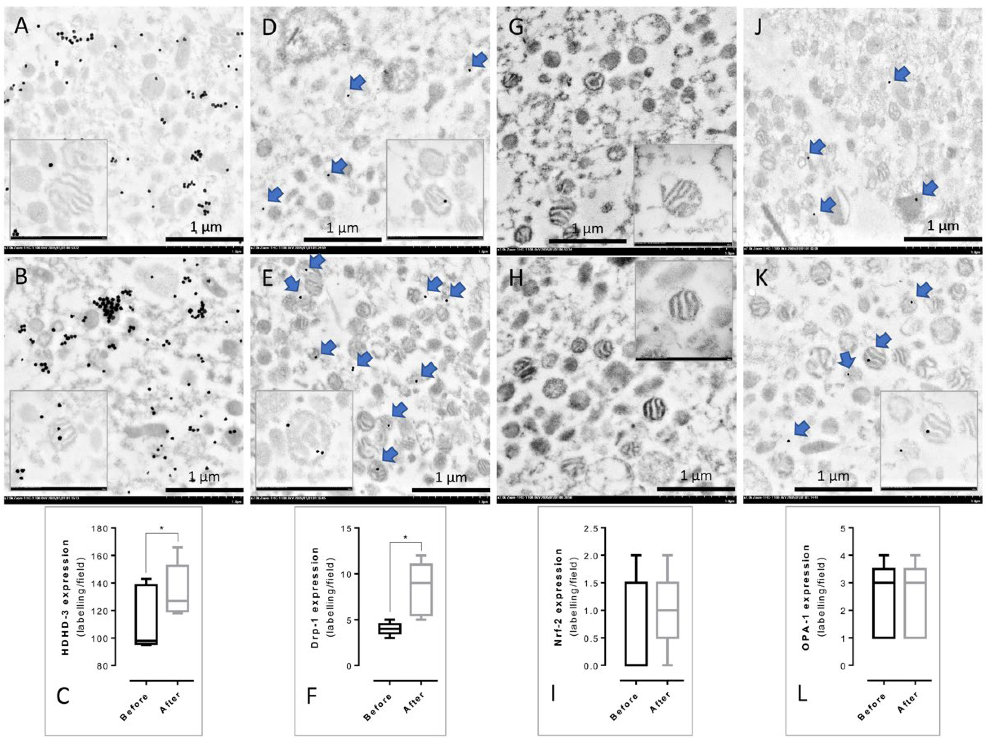 Nutrients 14 04538 g004 Nutrients 14 04538 g004