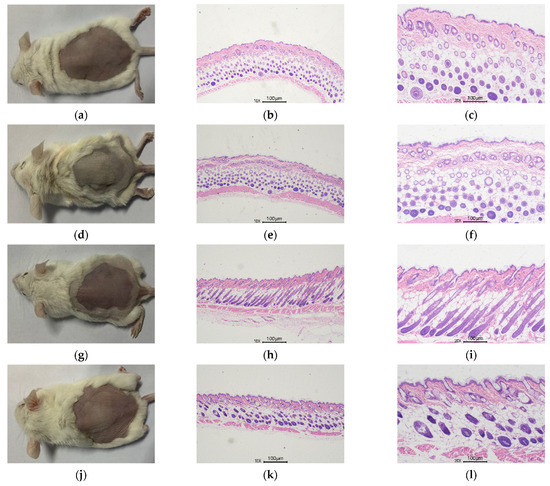 Puerarin Reduces Oxidative Damage and Photoaging Caused by