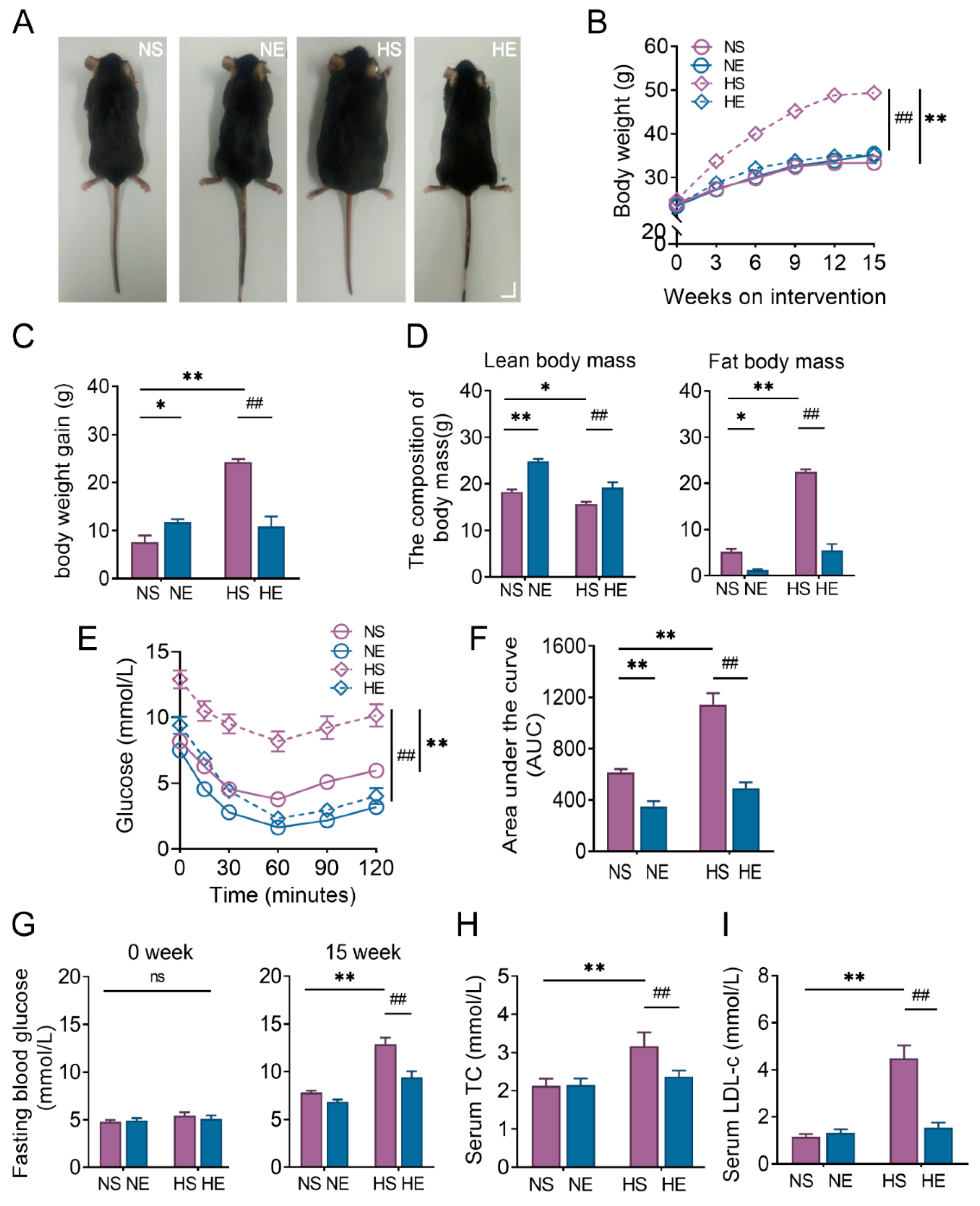 Moderate Treadmill Exercise Alleviates NAFLD by Regulating